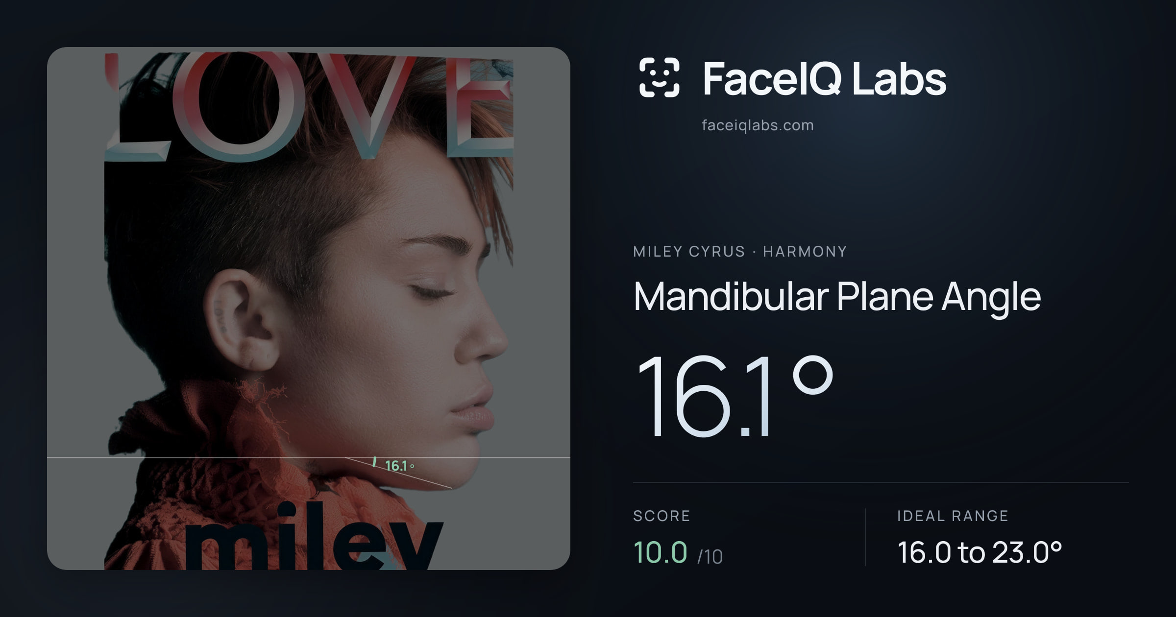 Miley Cyrus Mandibular Plane Angle: 16.1°, drawn on the photo