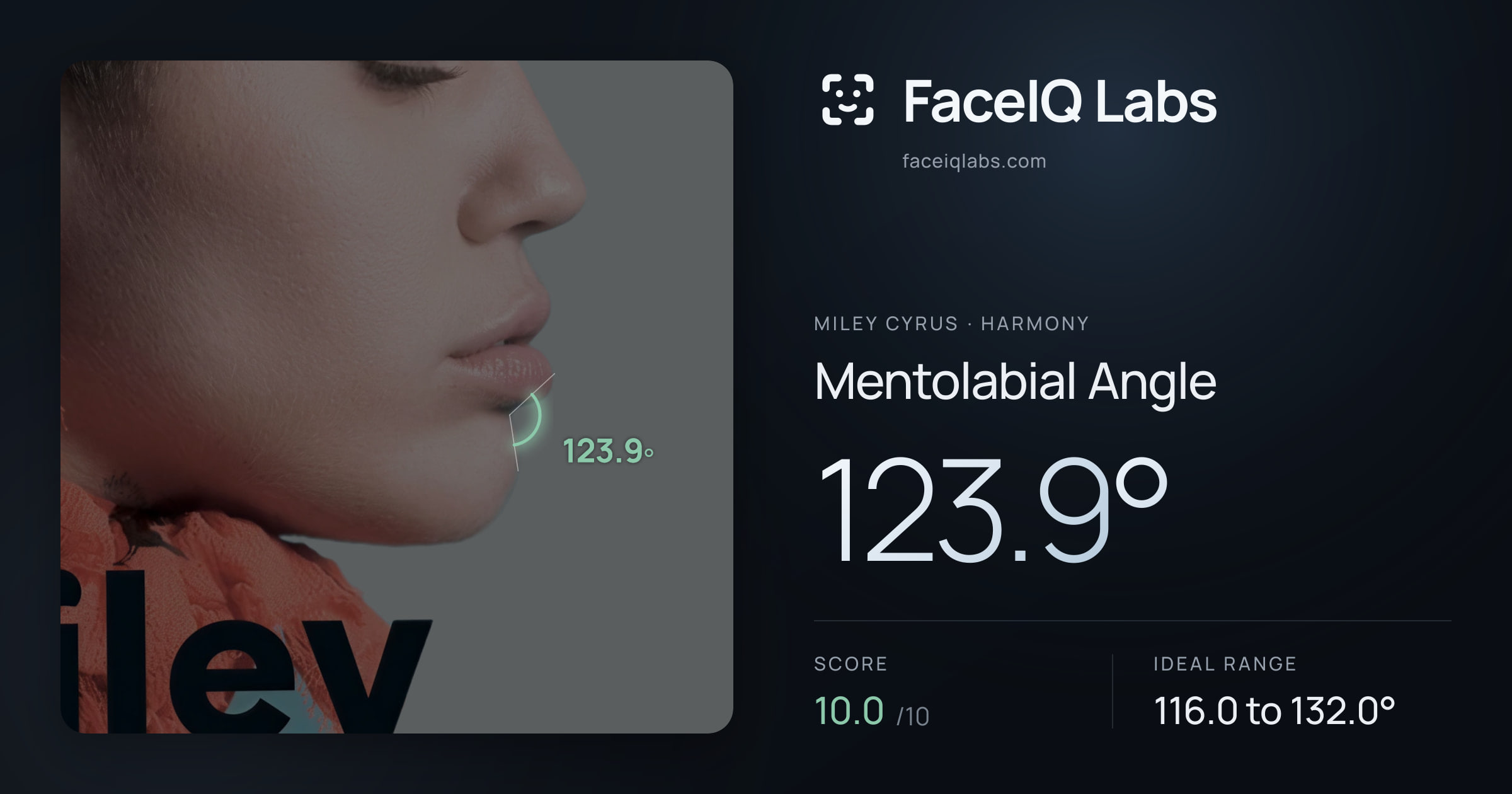 Miley Cyrus Mentolabial Angle: 123.9°, drawn on the photo