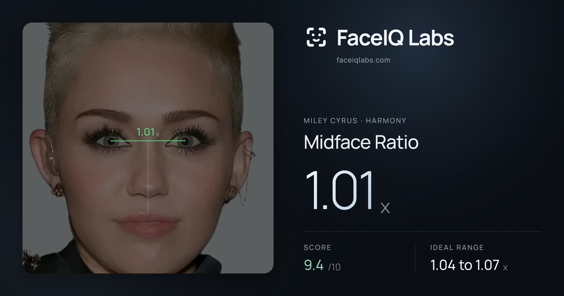 Miley Cyrus Midface Ratio: 1.01x, drawn on the photo