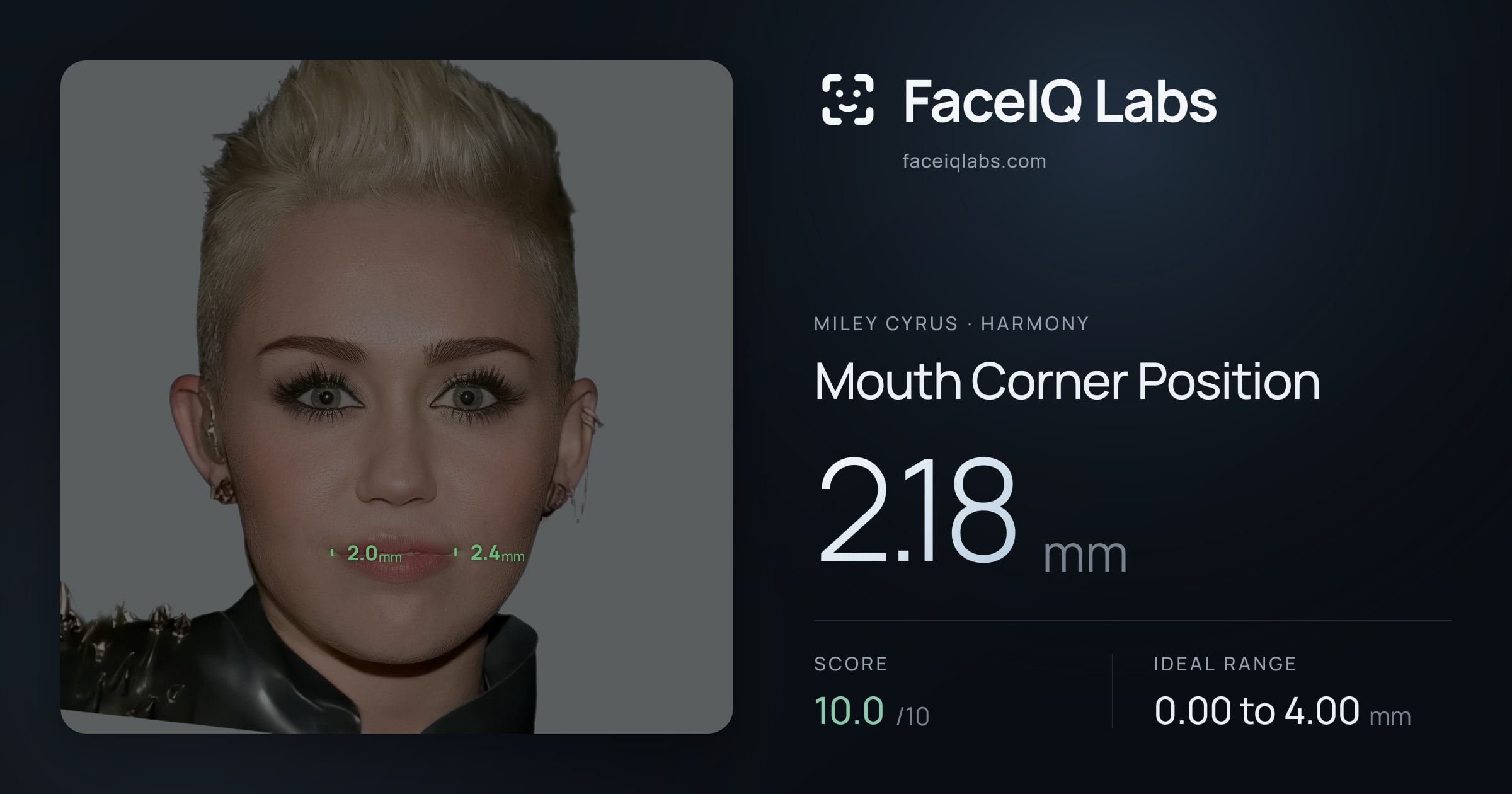 Miley Cyrus Mouth Corner Position: 2.18mm, drawn on the photo