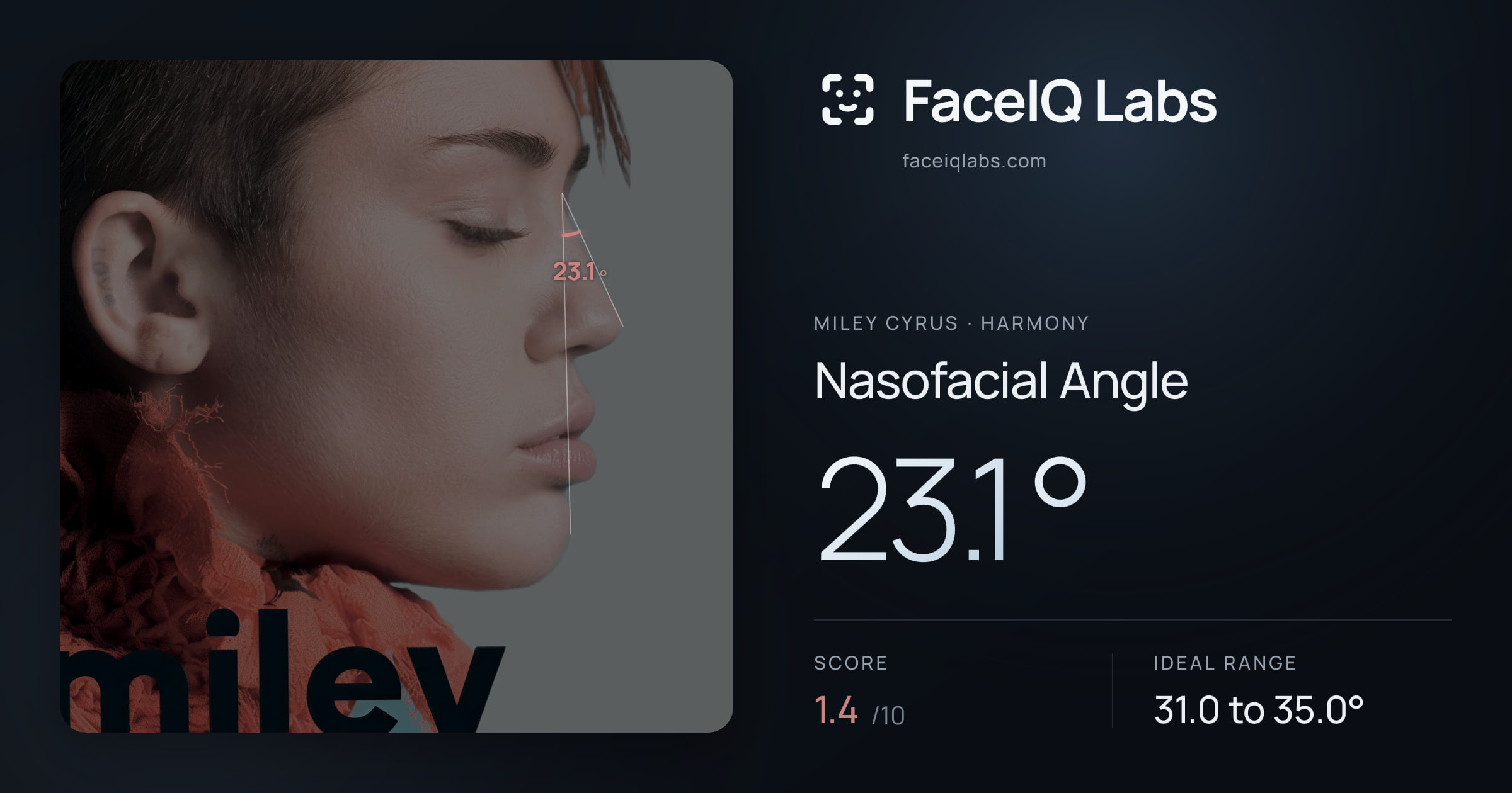 Miley Cyrus Nasofacial Angle: 23.1°, drawn on the photo