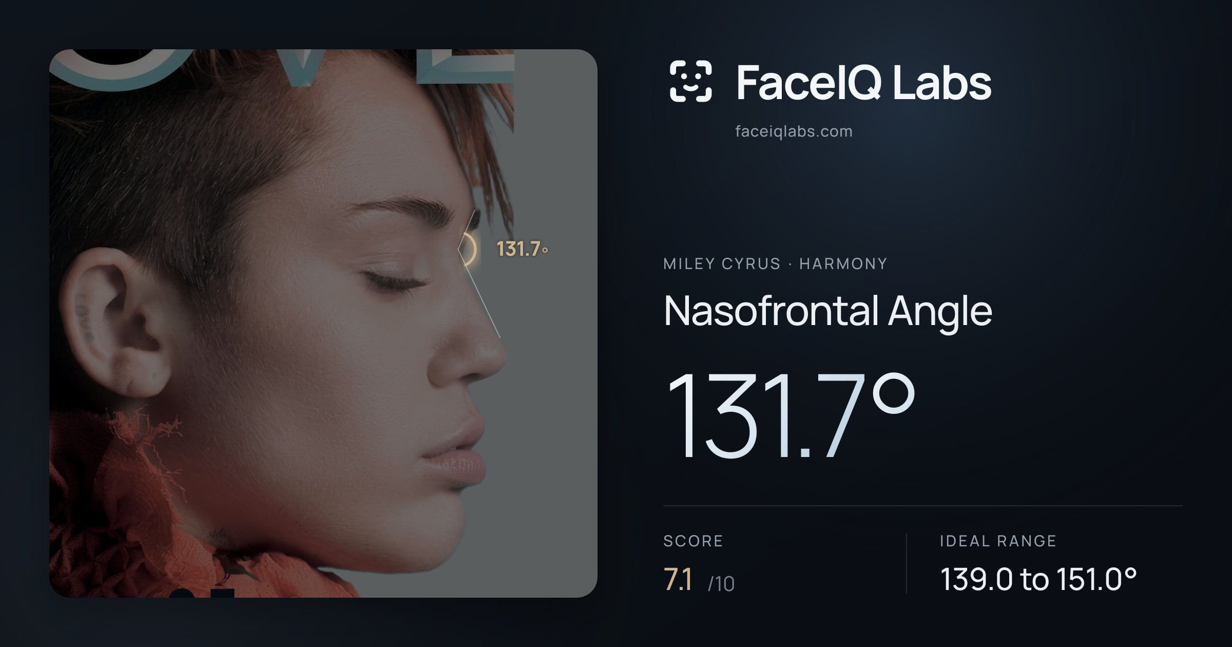 Miley Cyrus Nasofrontal Angle: 131.7°, drawn on the photo