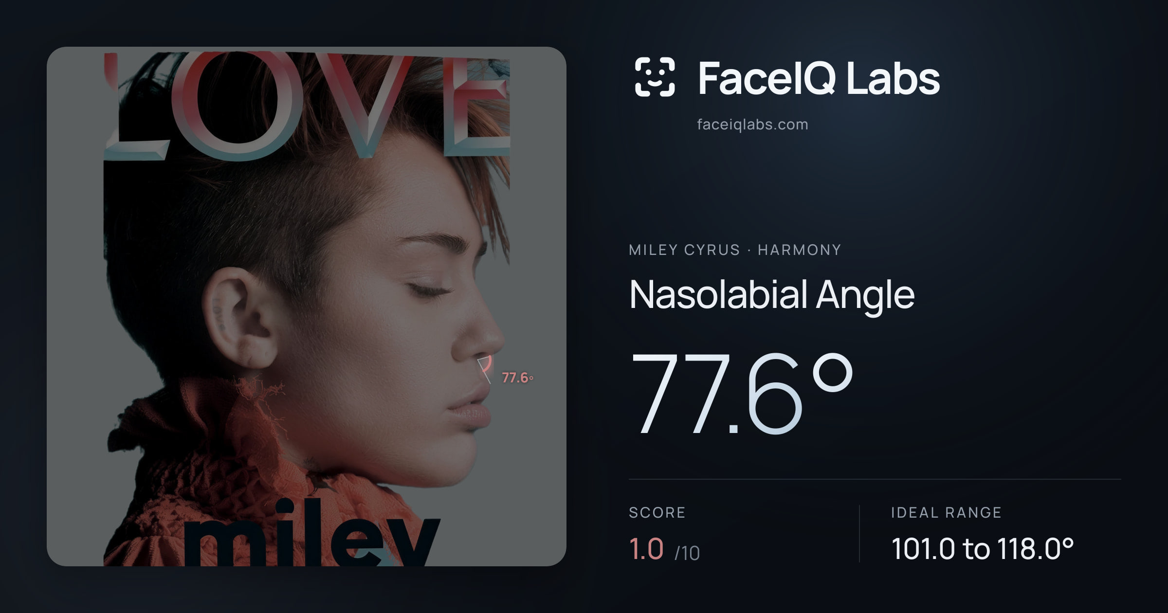 Miley Cyrus Nasolabial Angle: 77.6°, drawn on the photo