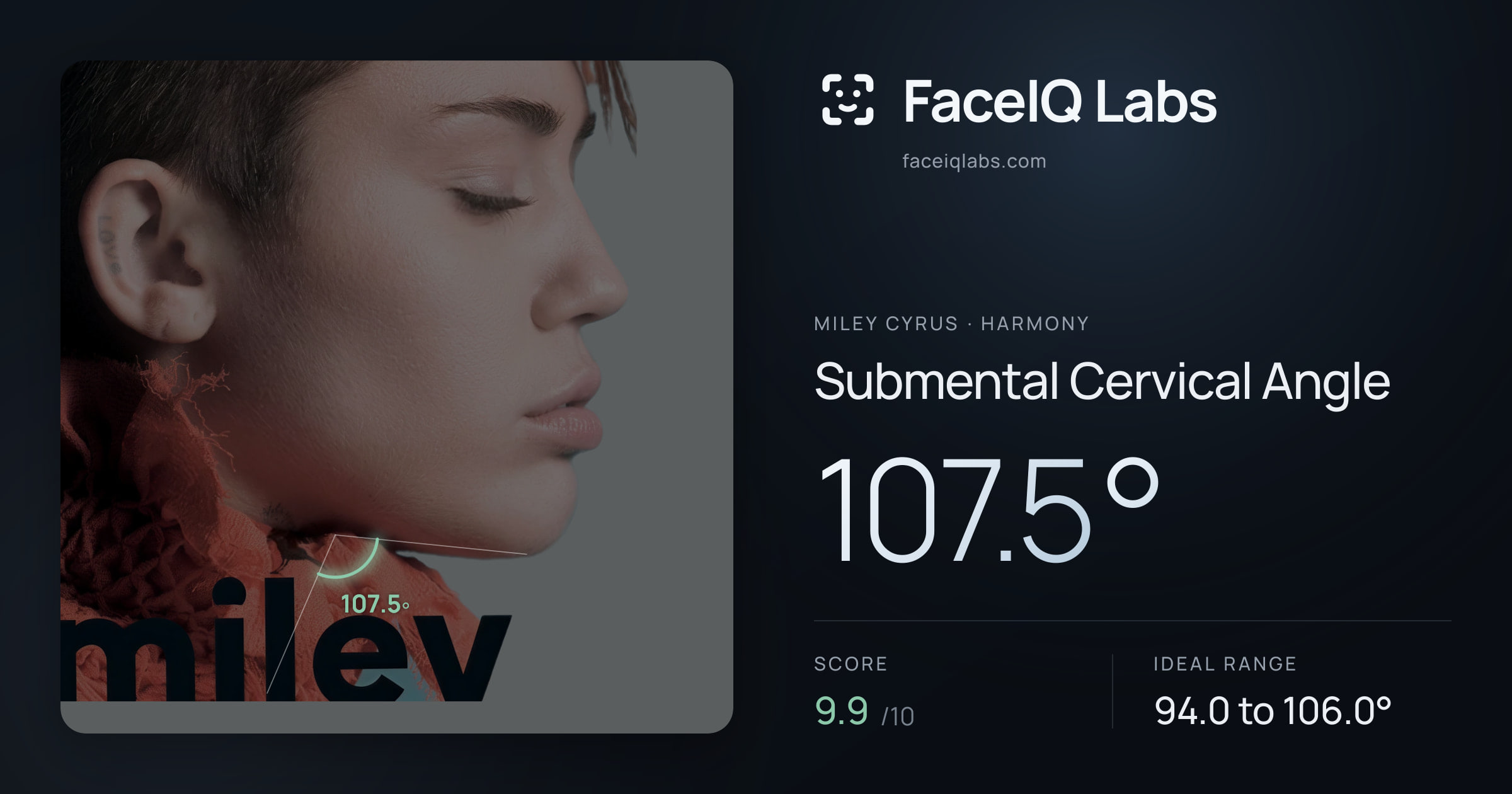 Miley Cyrus Submental Cervical Angle: 107.5°, drawn on the photo