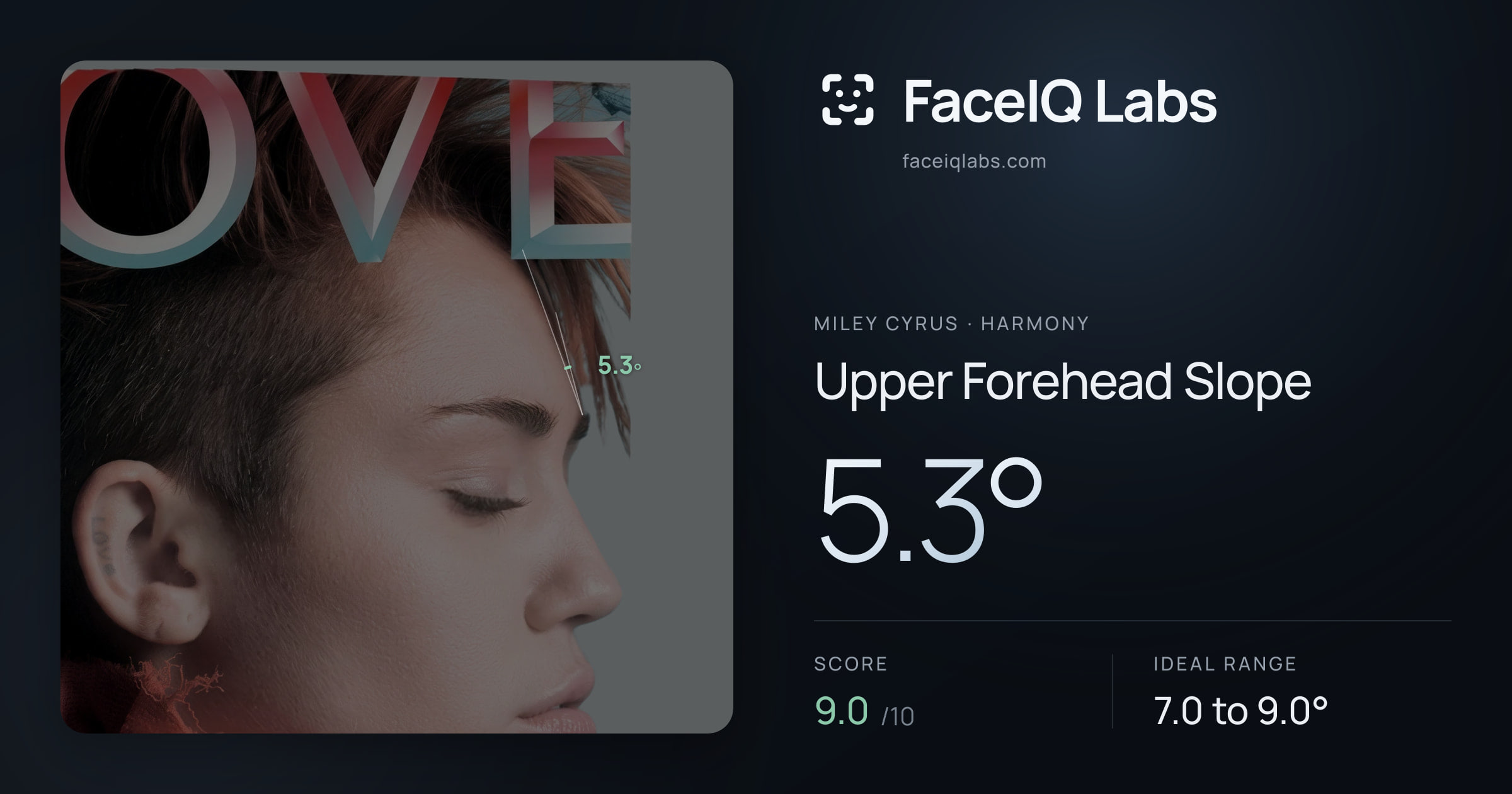 Miley Cyrus Upper Forehead Slope: 5.3°, drawn on the photo