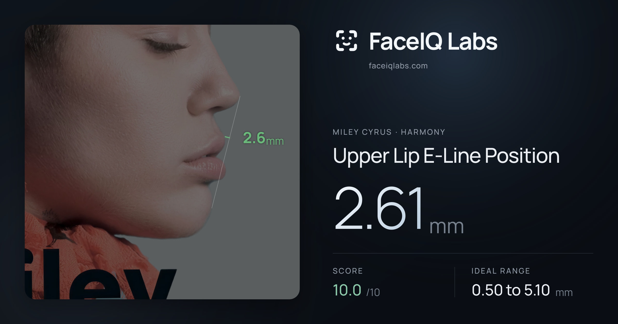 Miley Cyrus Upper Lip E-Line Position: 2.61mm, drawn on the photo