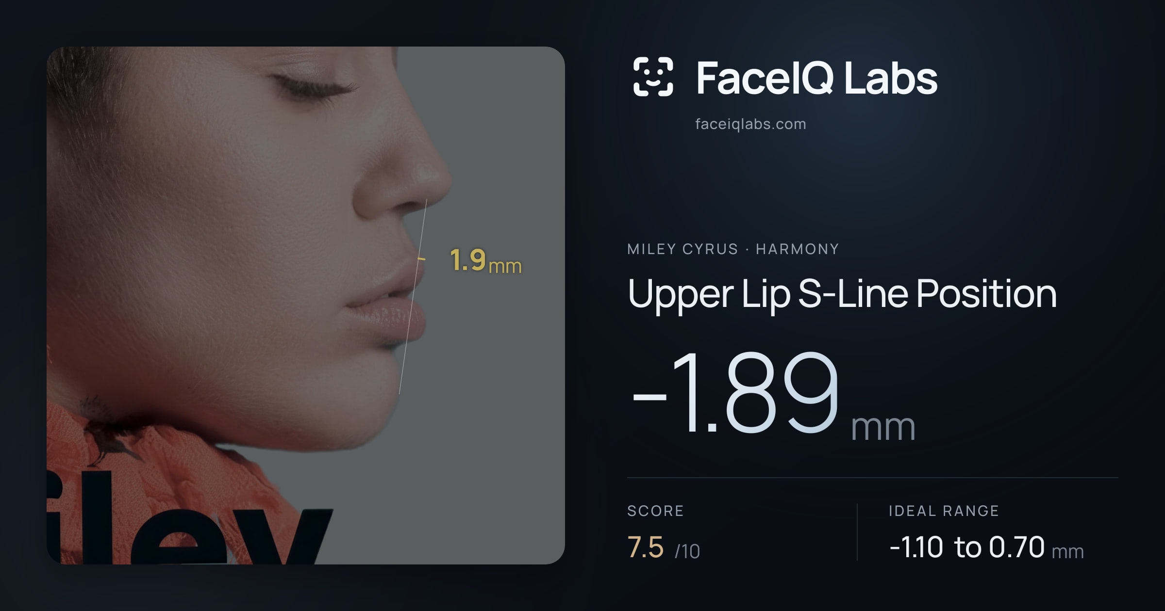 Miley Cyrus Upper Lip S-Line Position: -1.89mm, drawn on the photo