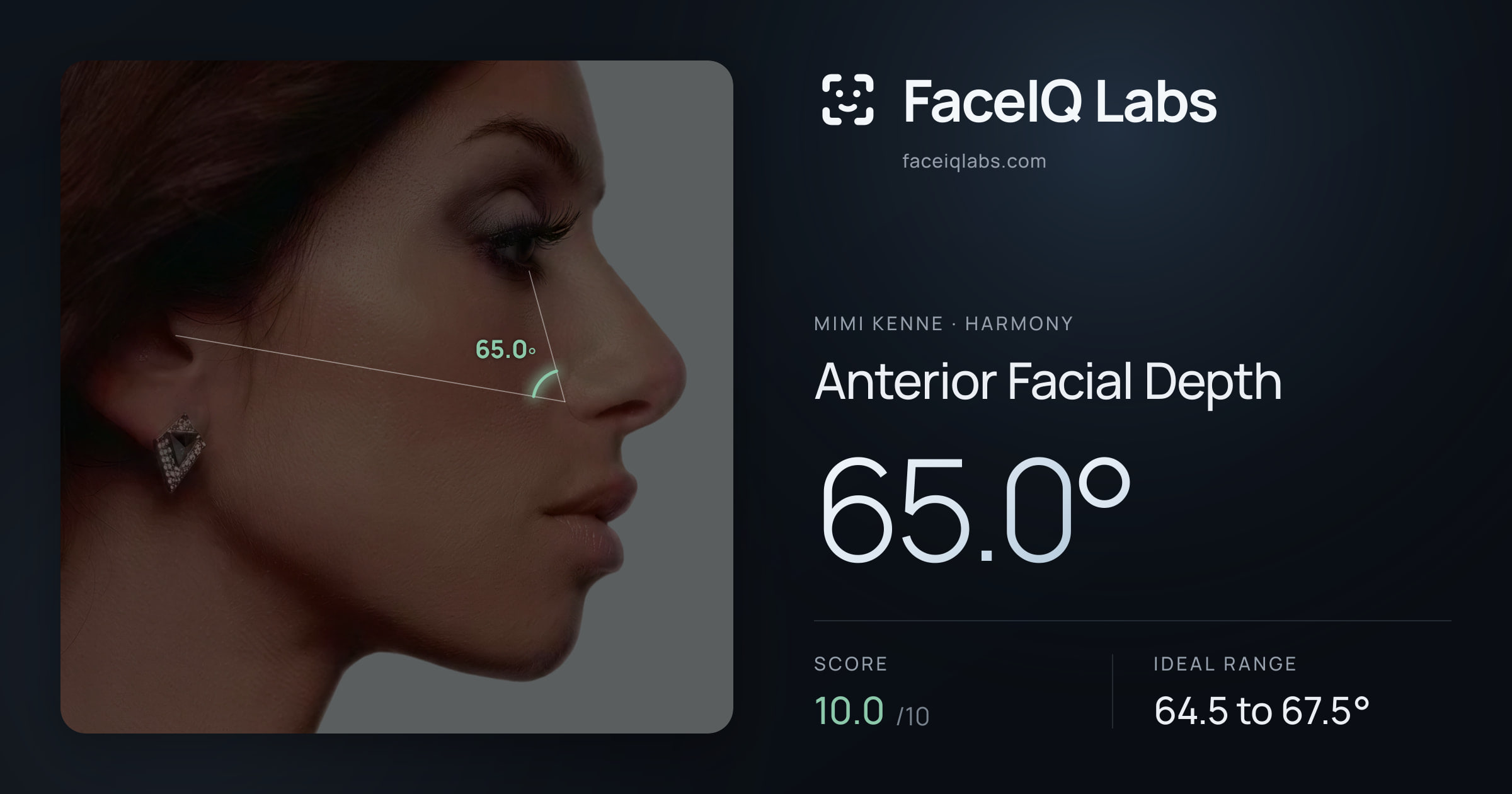 Mimi Kenne Anterior Facial Depth: 65.0°, drawn on the photo