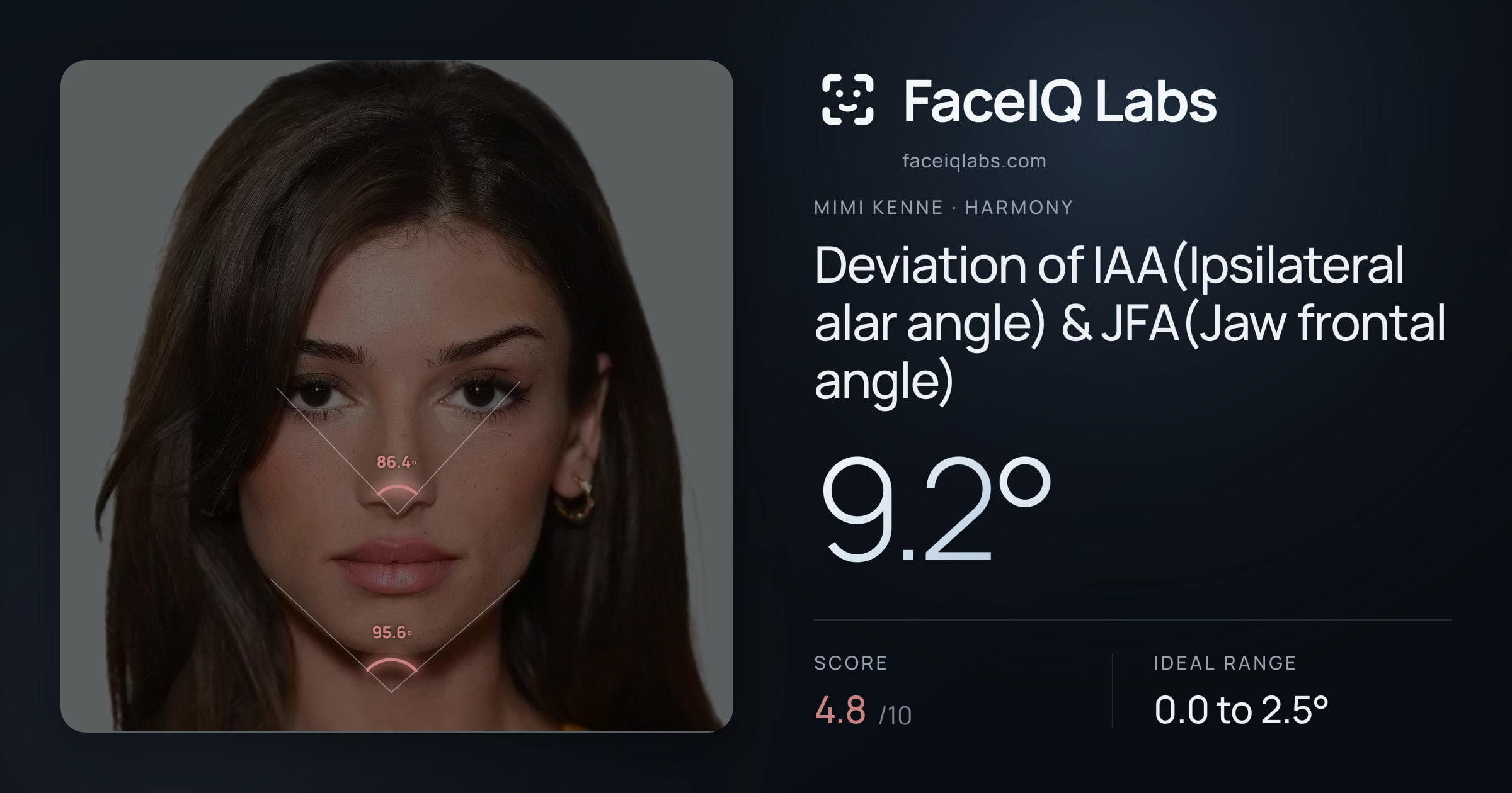 Mimi Kenne Deviation of IAA(Ipsilateral alar angle) & JFA(Jaw frontal angle): 9.2°, drawn on the photo