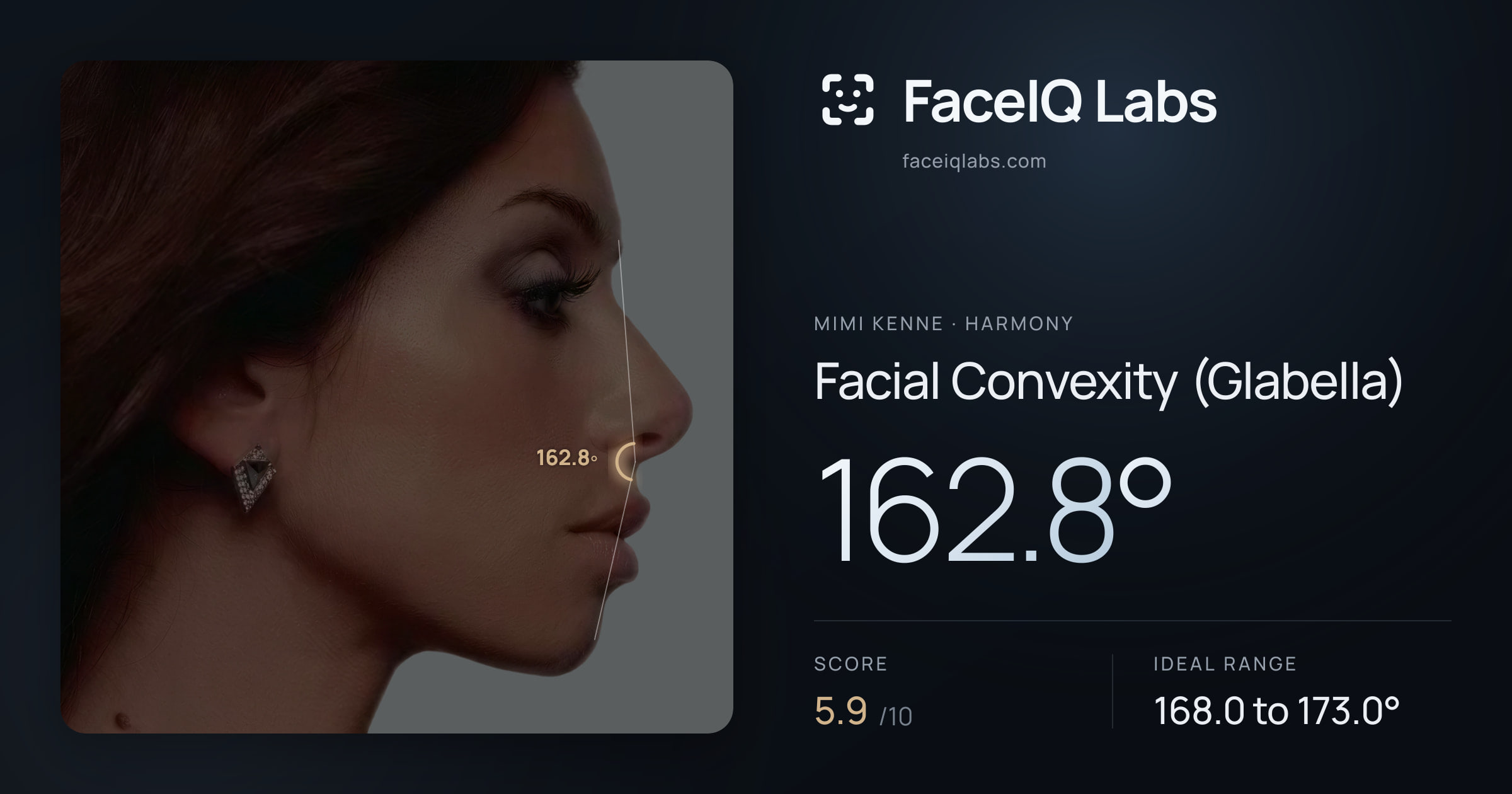 Mimi Kenne Facial Convexity (Glabella): 162.8°, drawn on the photo