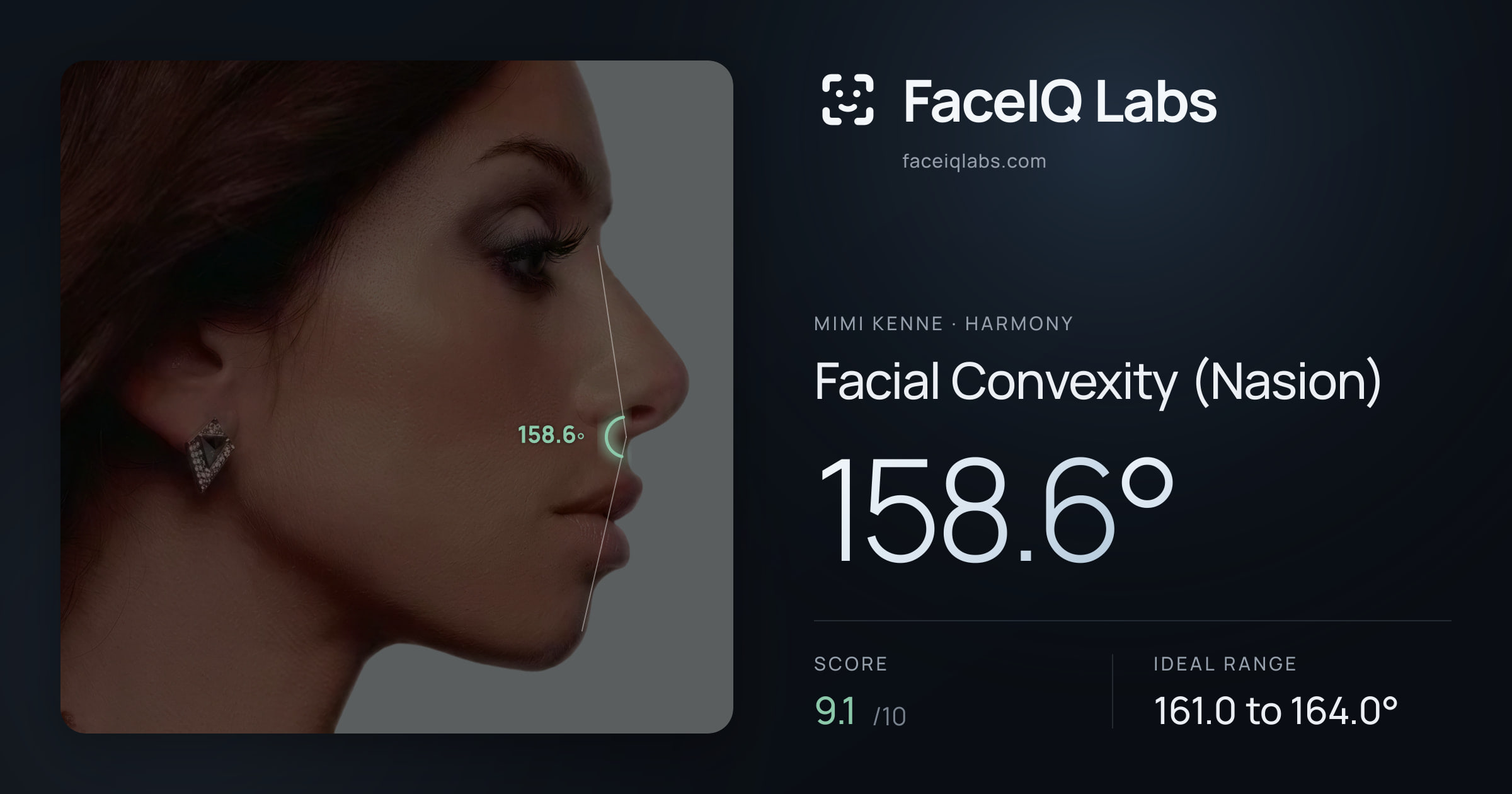 Mimi Kenne Facial Convexity (Nasion): 158.6°, drawn on the photo