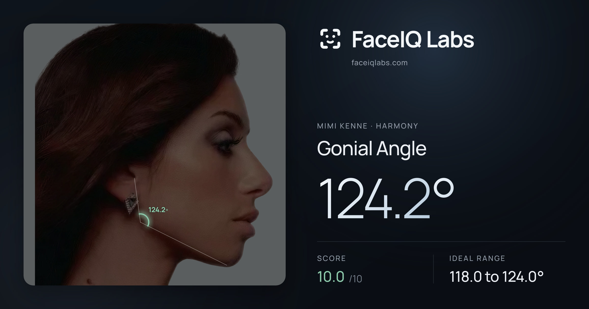 Mimi Kenne Gonial Angle: 124.2°, drawn on the photo