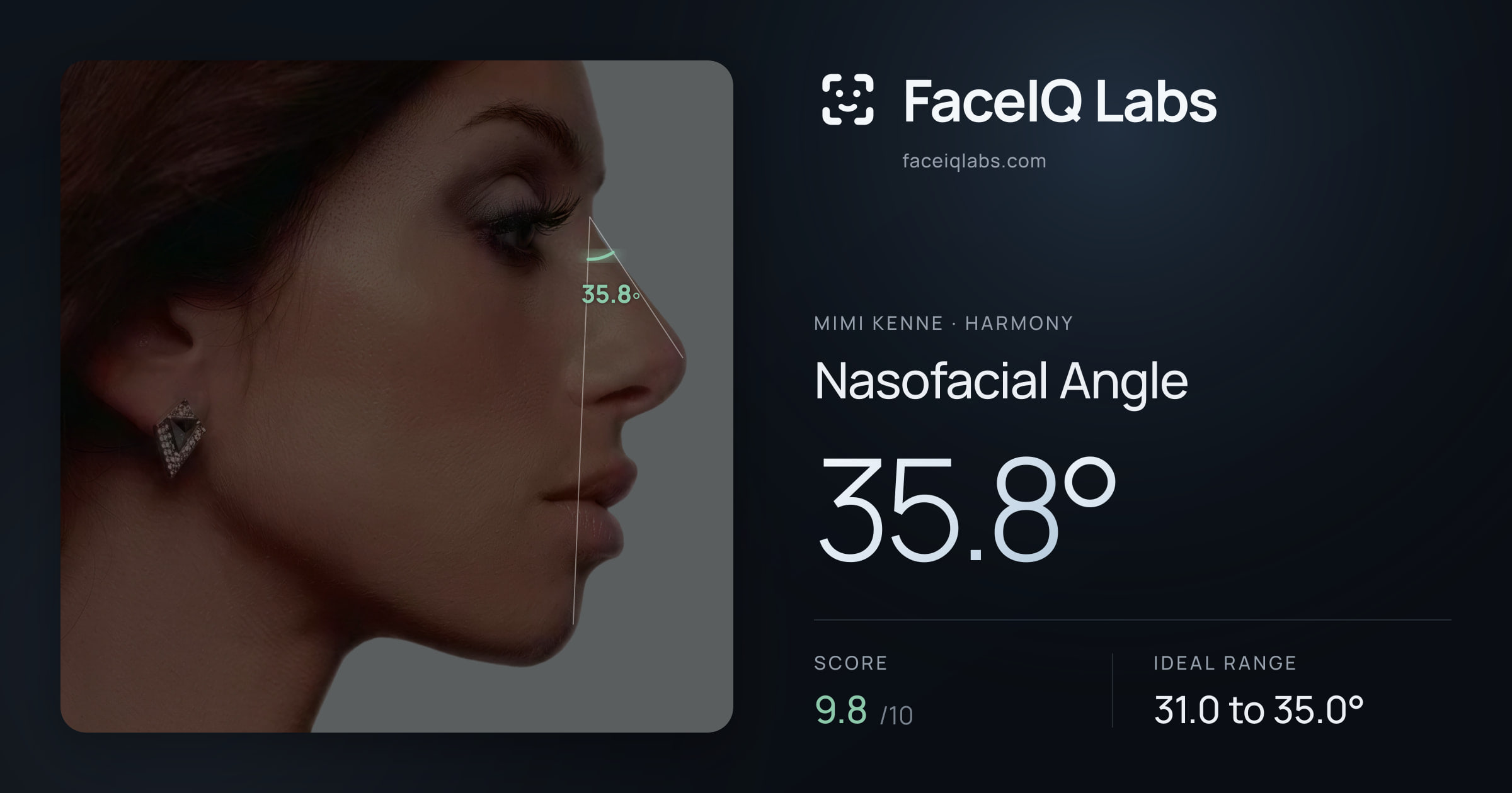 Mimi Kenne Nasofacial Angle: 35.8°, drawn on the photo