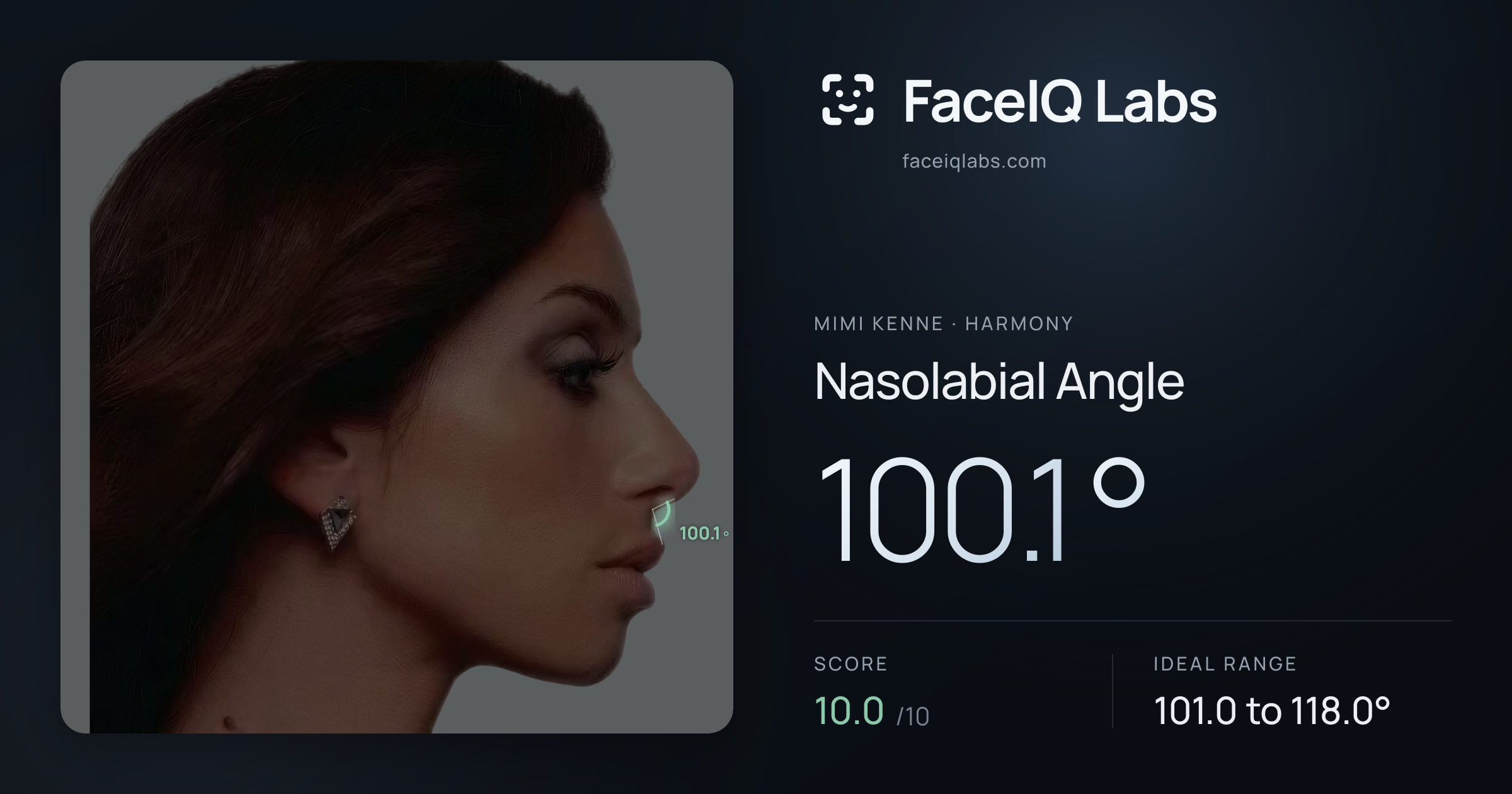 Mimi Kenne Nasolabial Angle: 100.1°, drawn on the photo