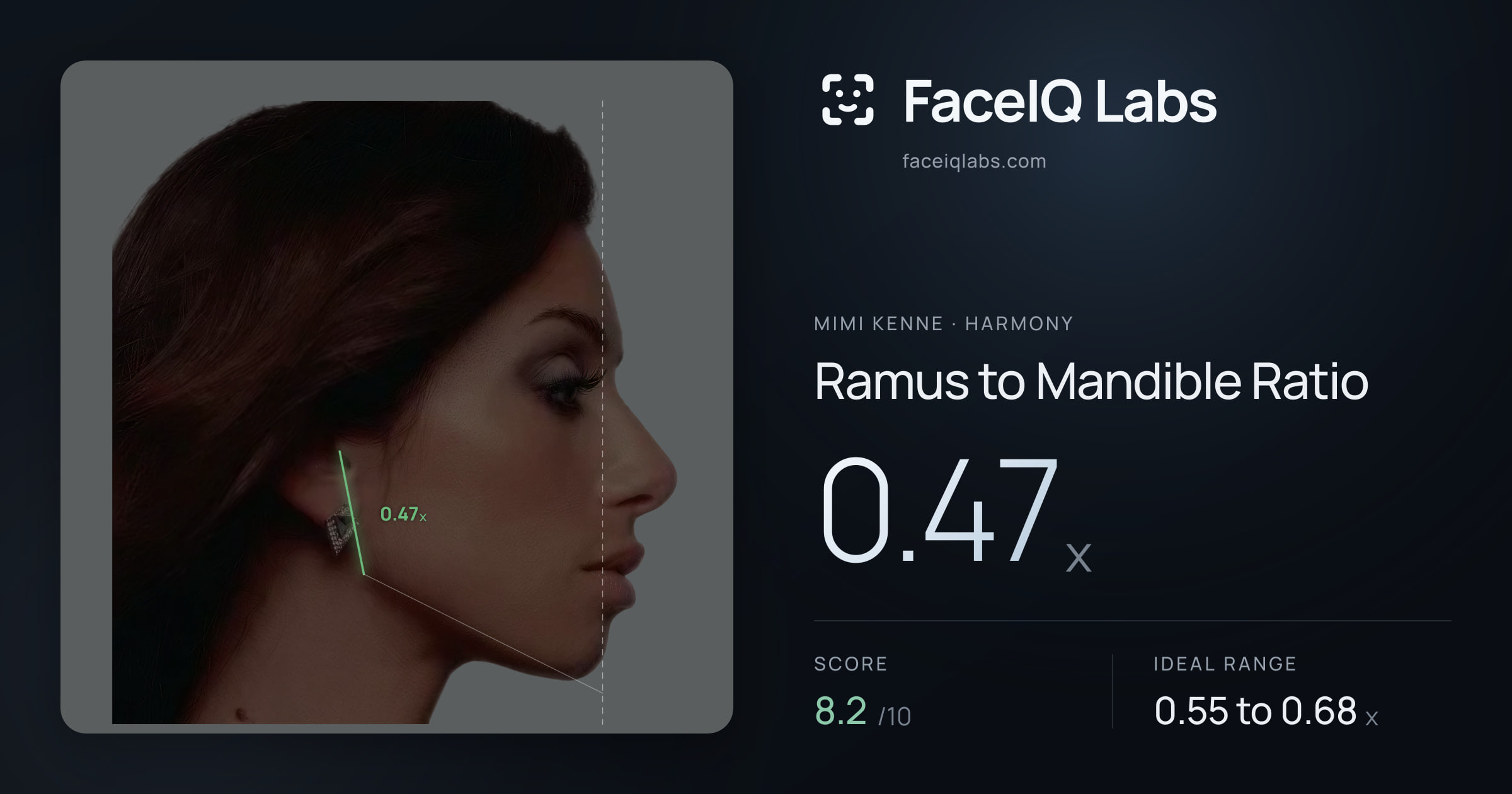 Mimi Kenne Ramus to Mandible Ratio: 0.47x, drawn on the photo