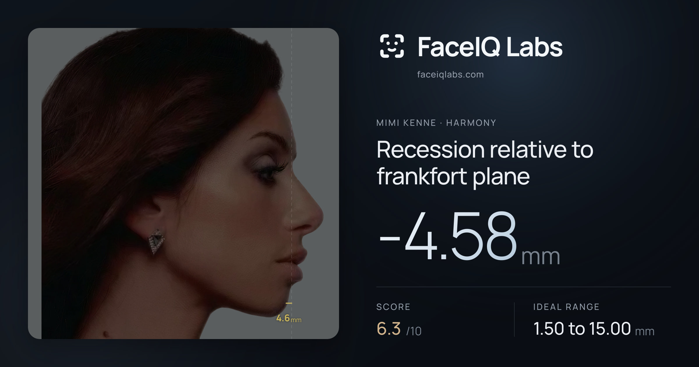 Mimi Kenne Recession relative to frankfort plane: -4.58mm, drawn on the photo