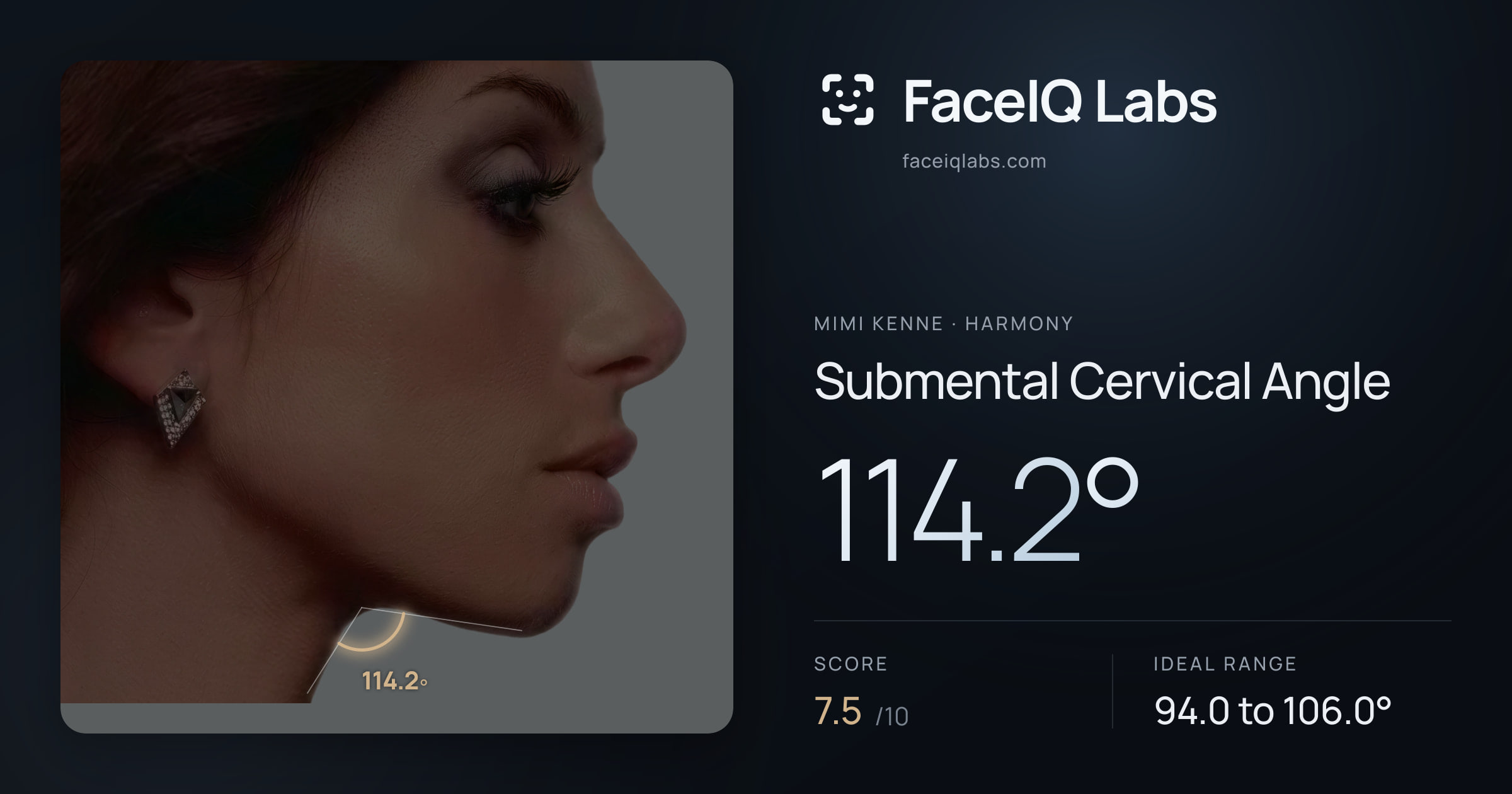 Mimi Kenne Submental Cervical Angle: 114.2°, drawn on the photo