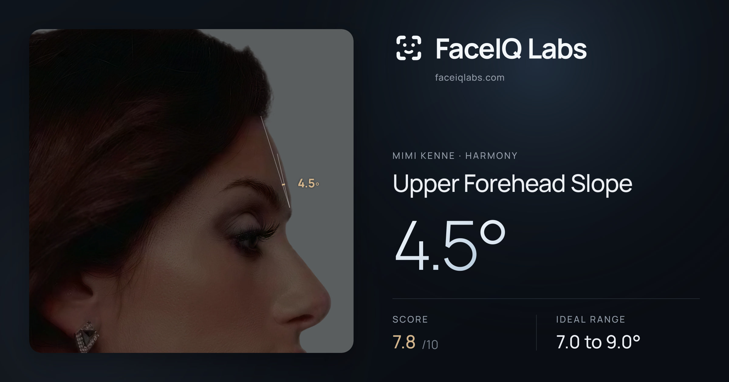 Mimi Kenne Upper Forehead Slope: 4.5°, drawn on the photo