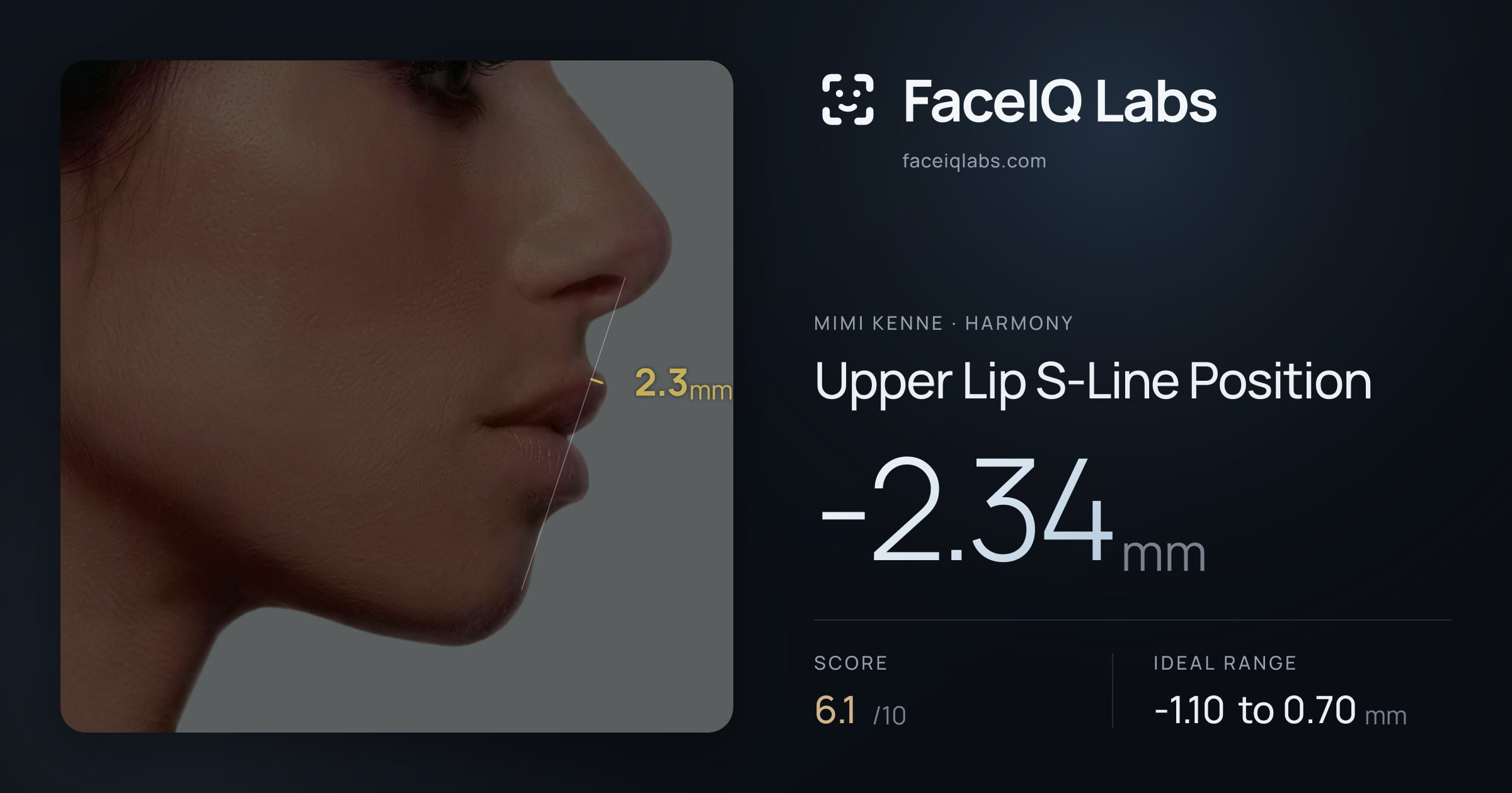 Mimi Kenne Upper Lip S-Line Position: -2.34mm, drawn on the photo