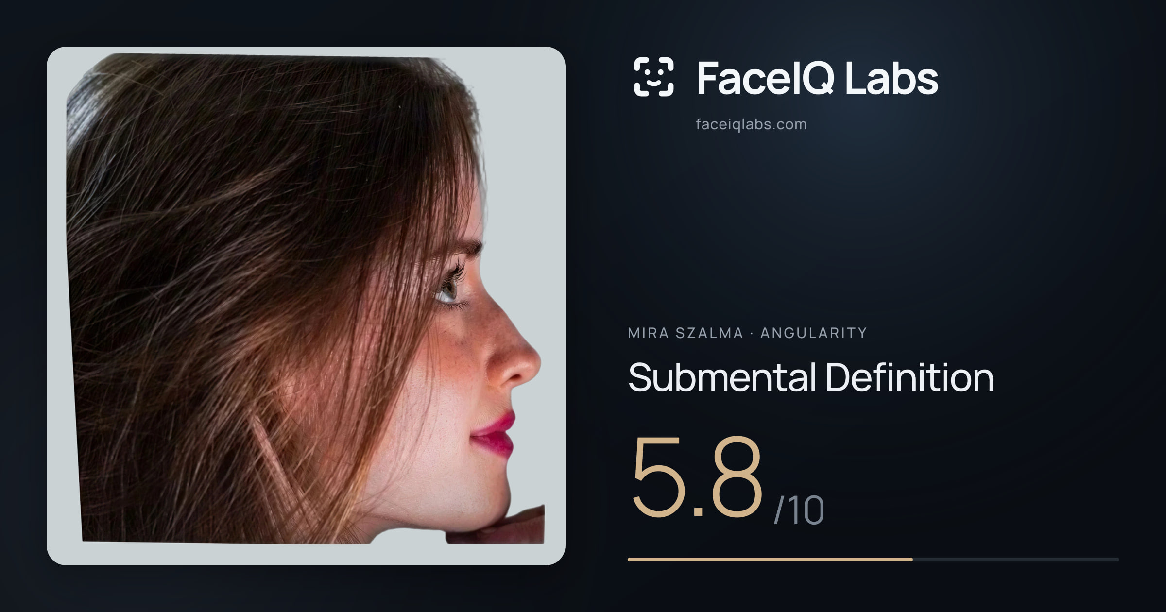 Mira Szalma Submental Definition: 5.8/10, drawn on the photo