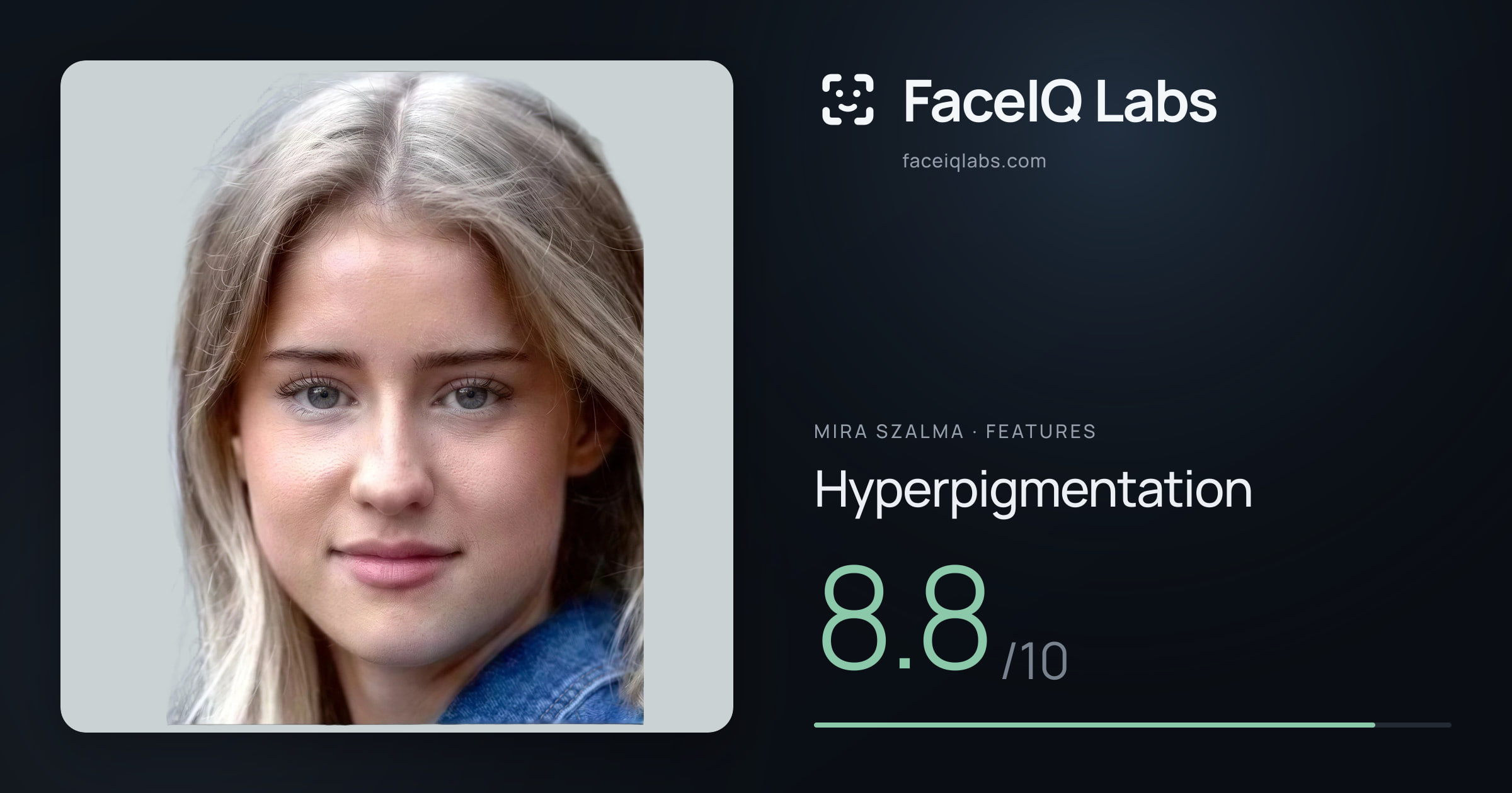 Mira Szalma Hyperpigmentation: 8.8/10, drawn on the photo