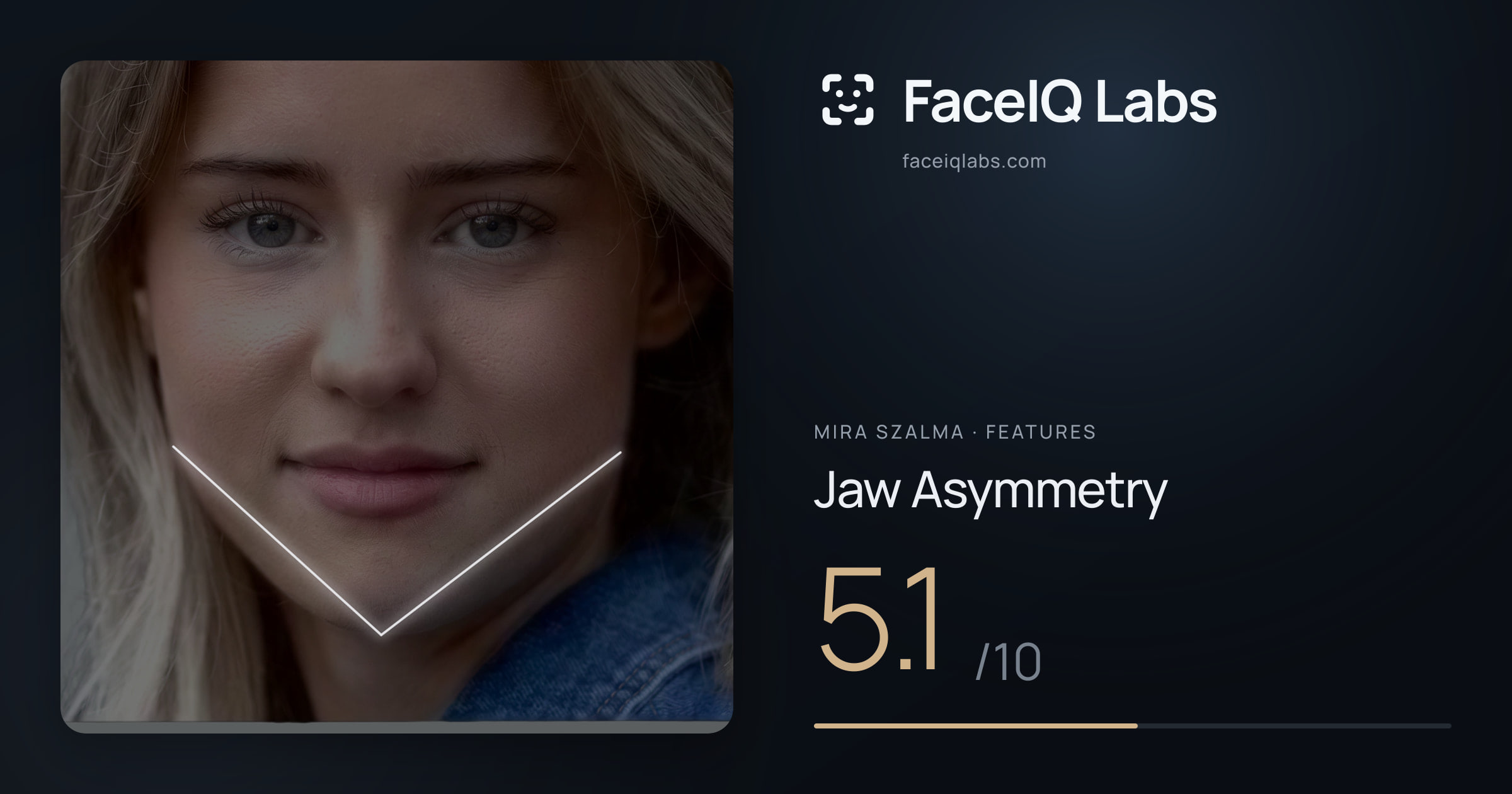 Mira Szalma Jaw Asymmetry: 5.1/10, drawn on the photo