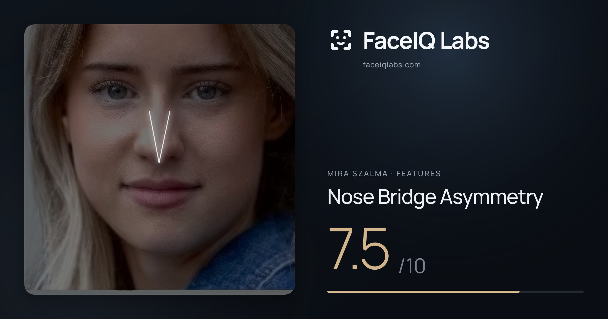 Mira Szalma Nose Bridge Asymmetry: 7.5/10, drawn on the photo