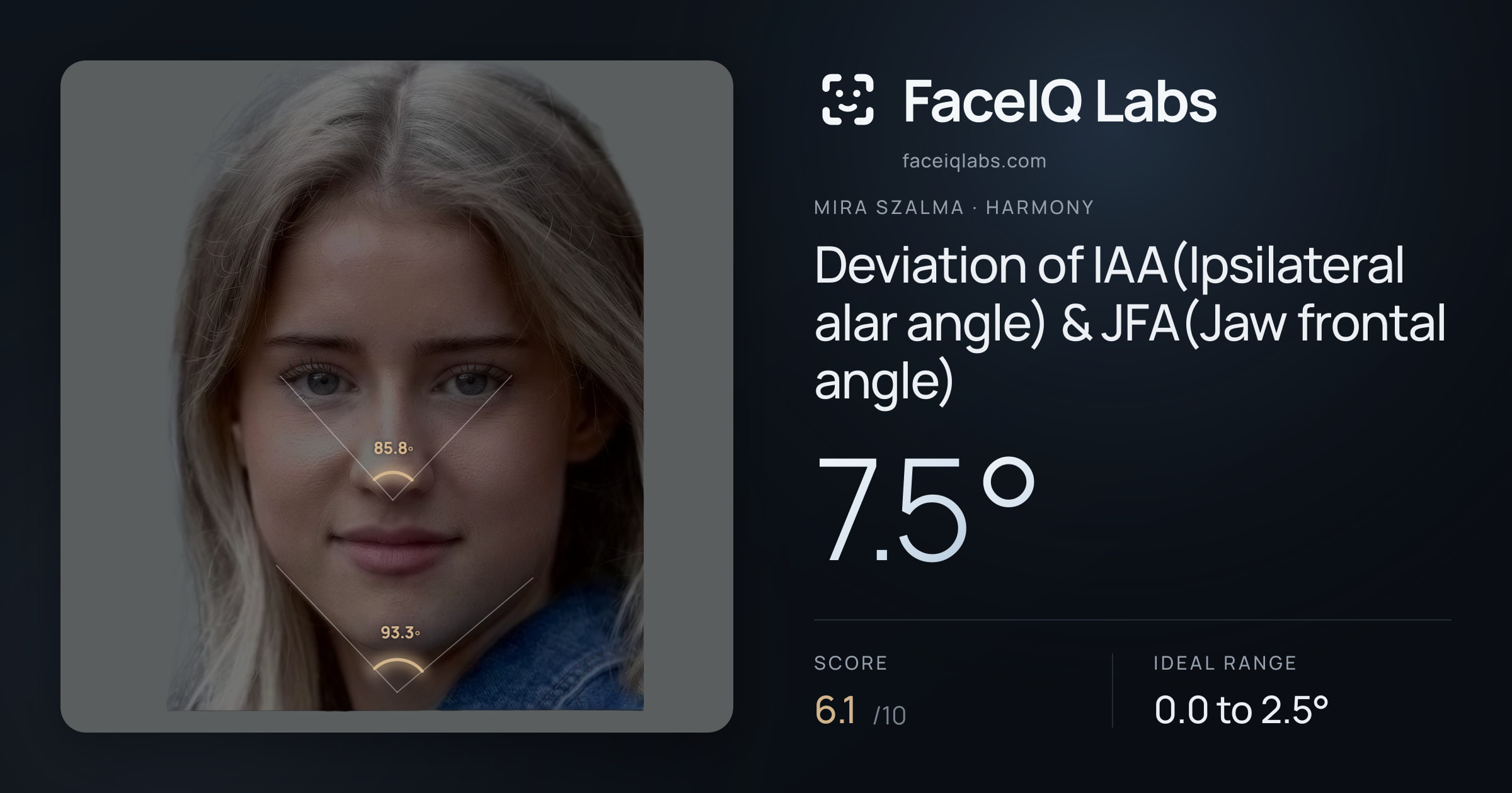Mira Szalma Deviation of IAA(Ipsilateral alar angle) & JFA(Jaw frontal angle): 7.5°, drawn on the photo