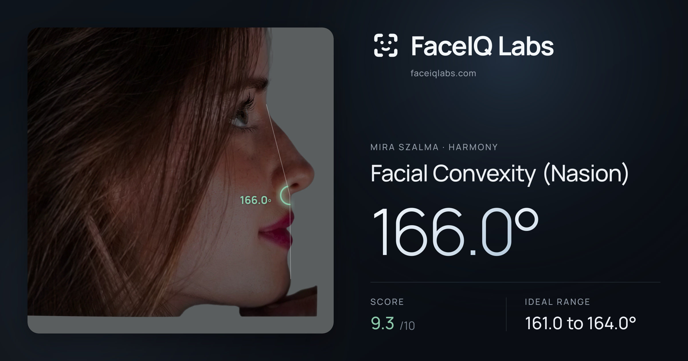 Mira Szalma Facial Convexity (Nasion): 166.0°, drawn on the photo