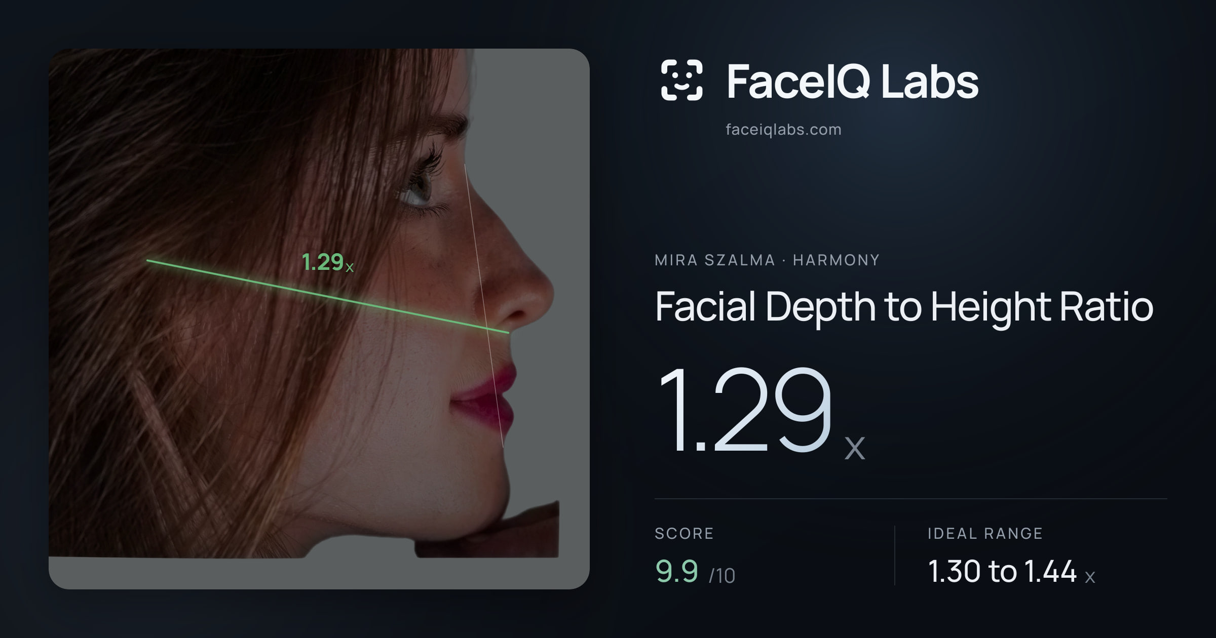 Mira Szalma Facial Depth to Height Ratio: 1.29x, drawn on the photo