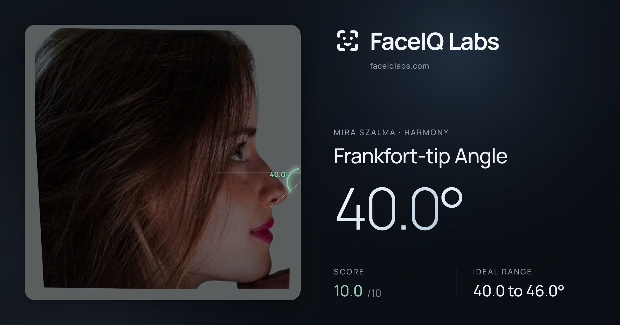 Mira Szalma Frankfort-tip Angle: 40.0°, drawn on the photo