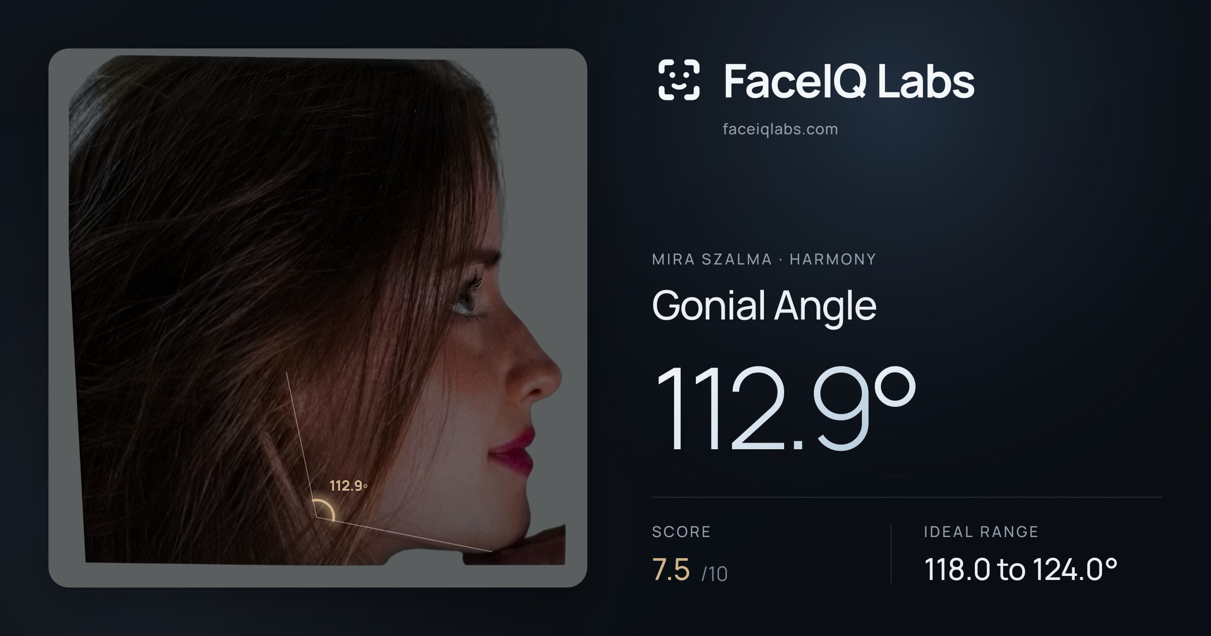 Mira Szalma Gonial Angle: 112.9°, drawn on the photo