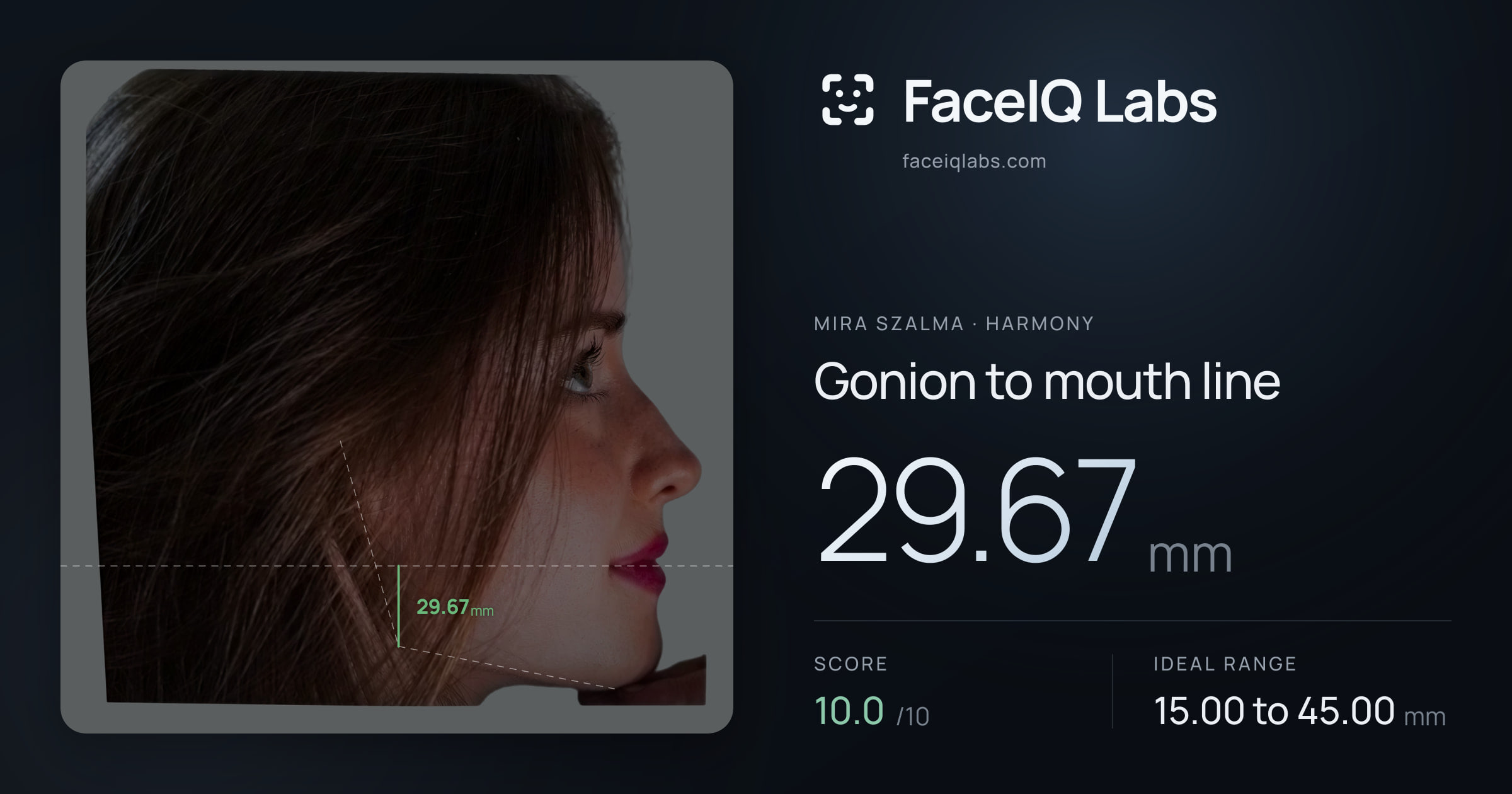 Mira Szalma Gonion to mouth line: 29.67mm, drawn on the photo