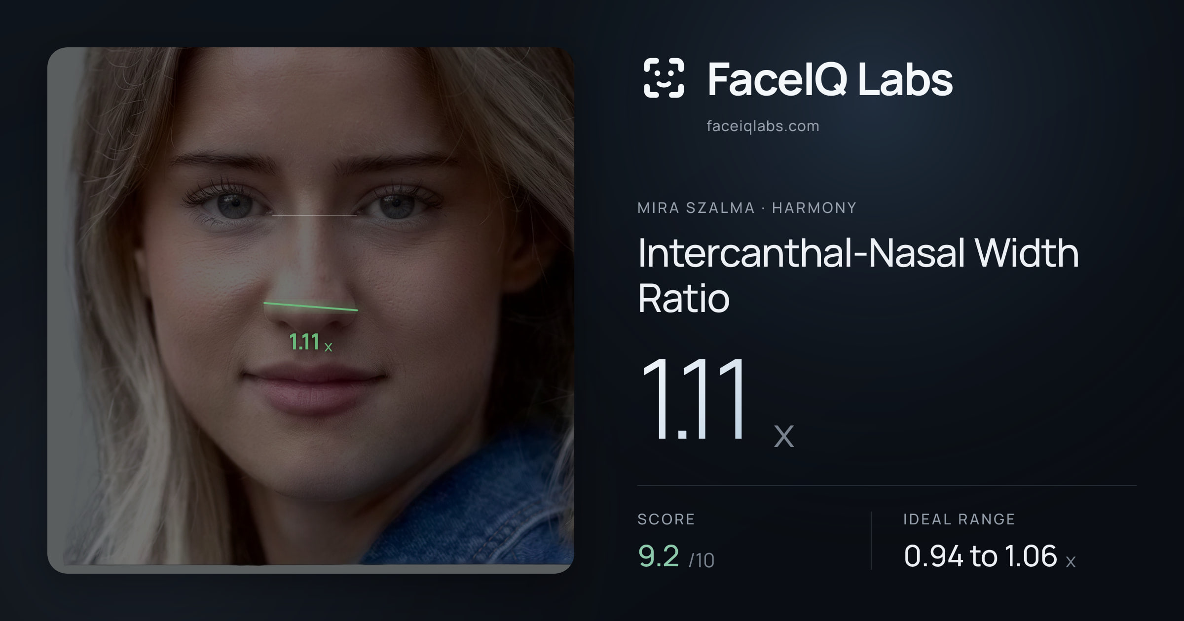 Mira Szalma Intercanthal-Nasal Width Ratio: 1.11x, drawn on the photo