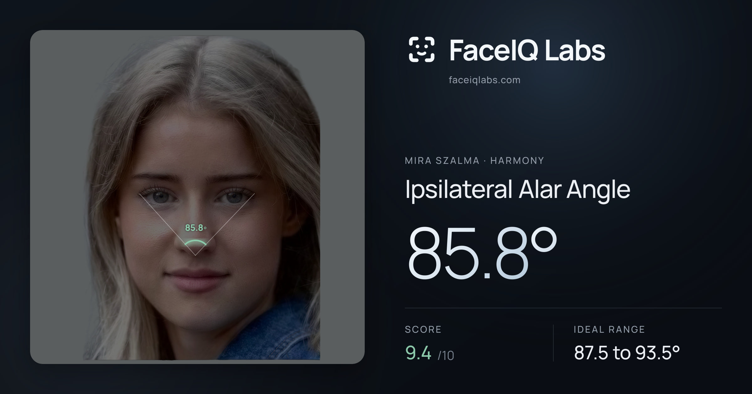 Mira Szalma Ipsilateral Alar Angle: 85.8°, drawn on the photo