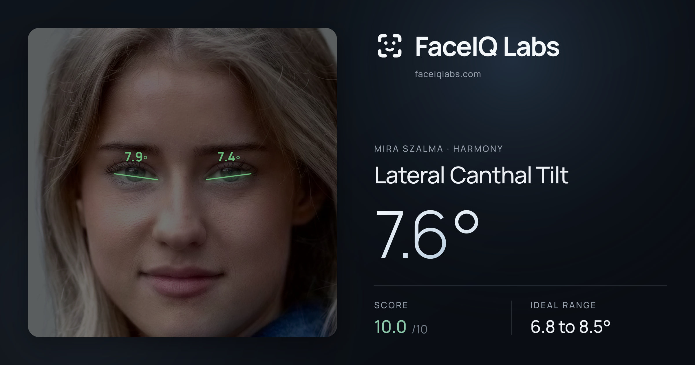 Mira Szalma Lateral Canthal Tilt: 7.6°, drawn on the photo