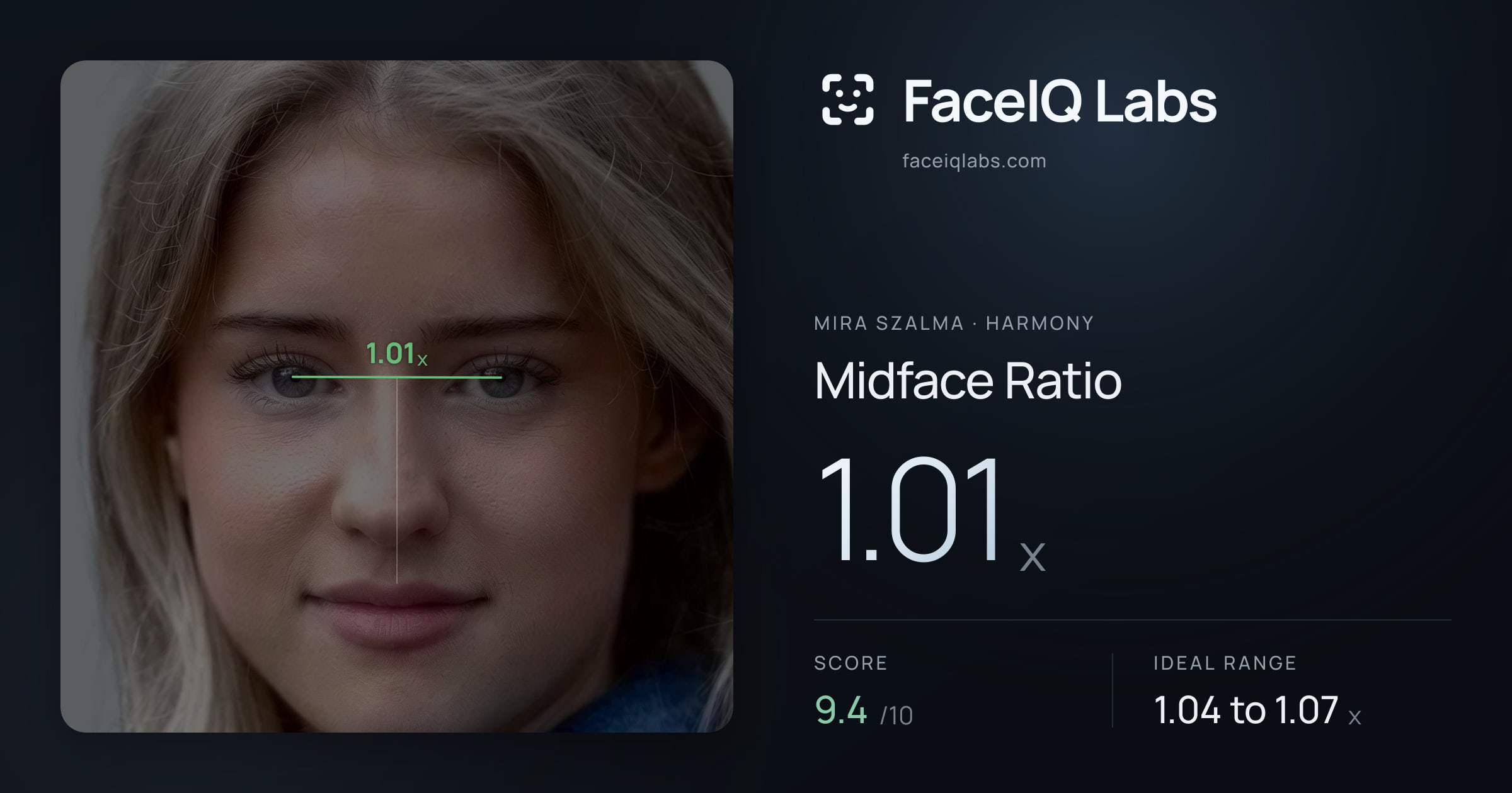 Mira Szalma Midface Ratio: 1.01x, drawn on the photo
