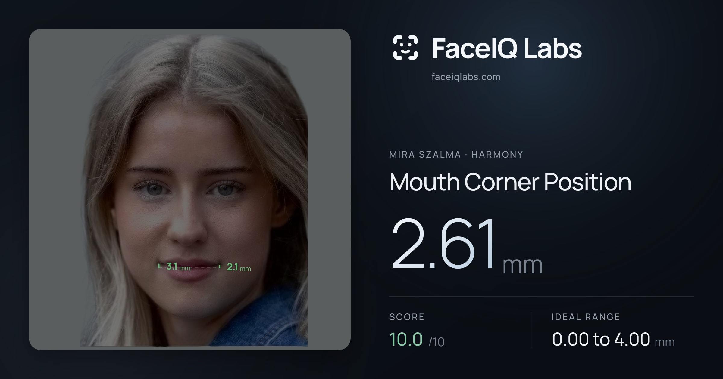 Mira Szalma Mouth Corner Position: 2.61mm, drawn on the photo