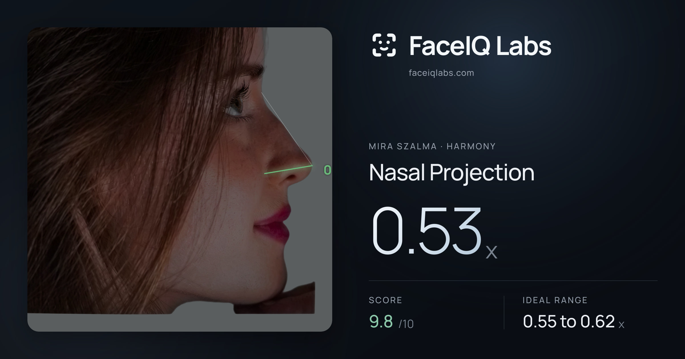 Mira Szalma Nasal Projection: 0.53x, drawn on the photo