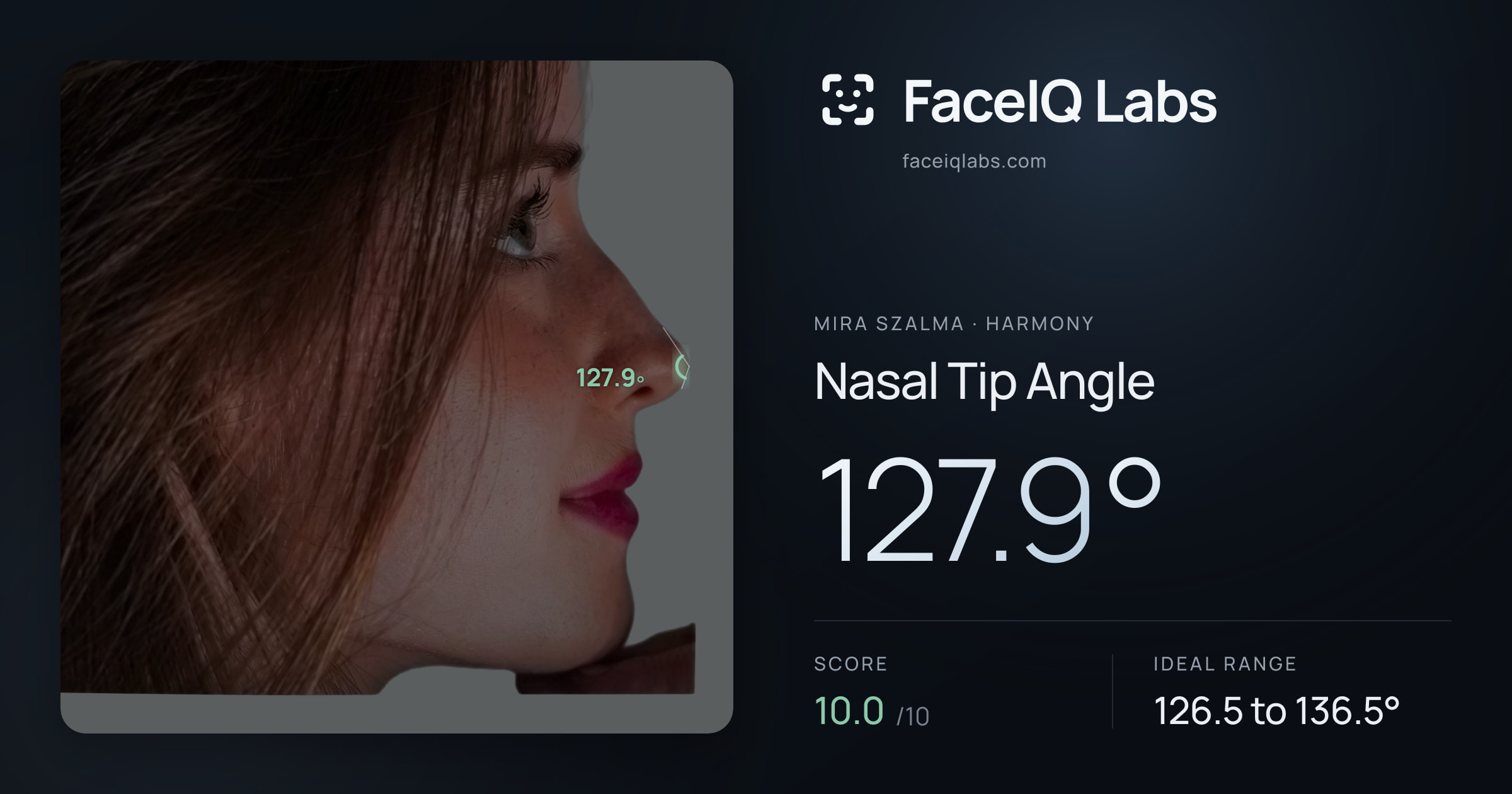 Mira Szalma Nasal Tip Angle: 127.9°, drawn on the photo