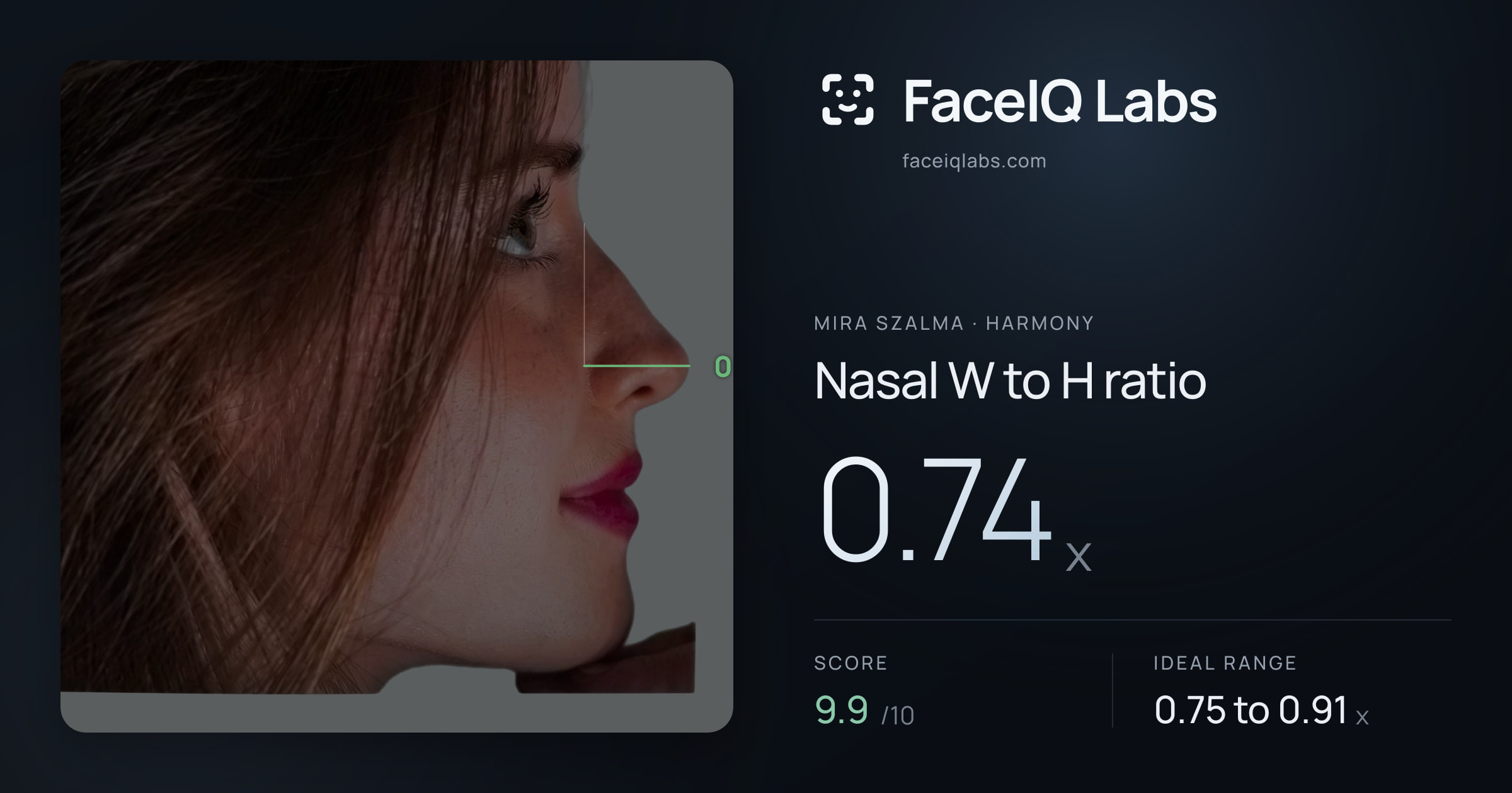 Mira Szalma Nasal W to H ratio: 0.74x, drawn on the photo
