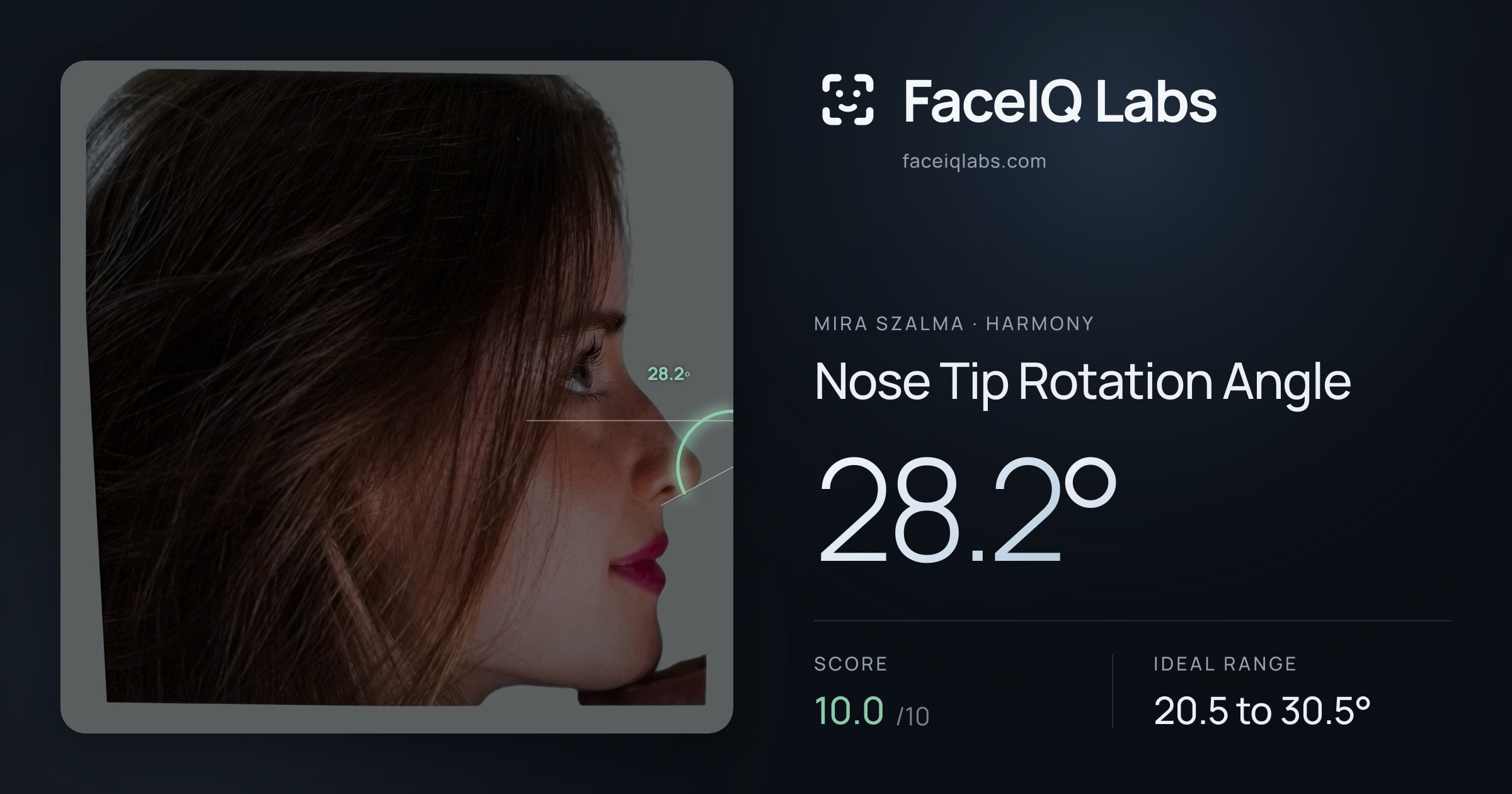 Mira Szalma Nose Tip Rotation Angle: 28.2°, drawn on the photo