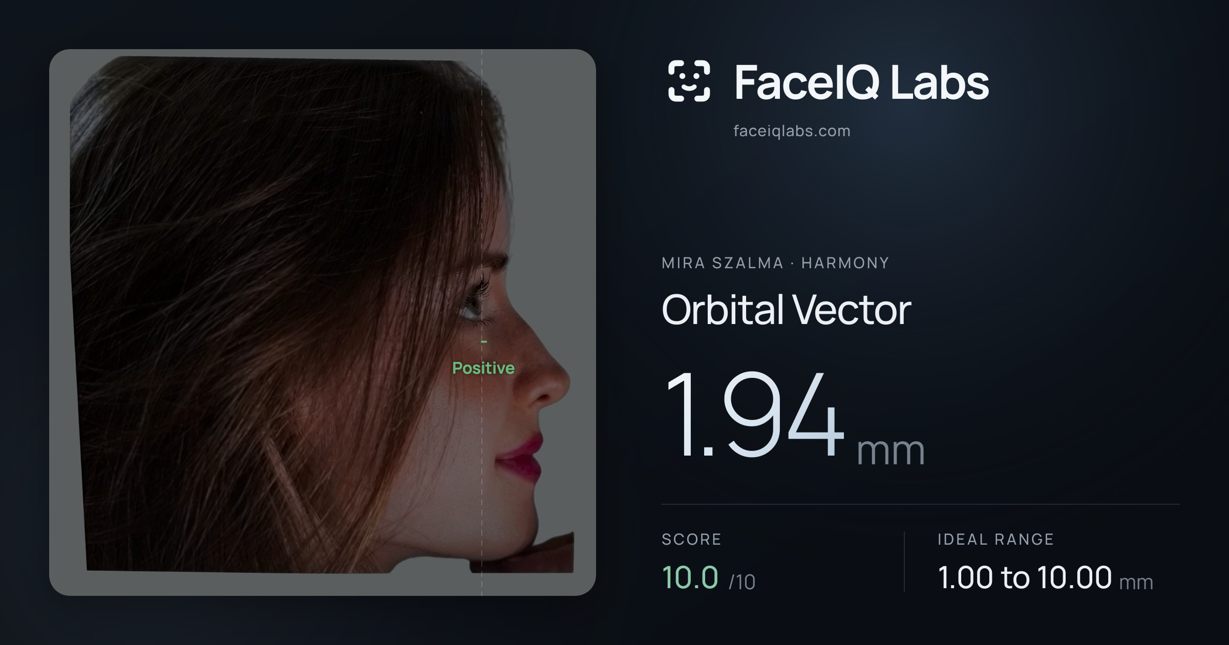 Mira Szalma Orbital Vector: 1.94mm, drawn on the photo