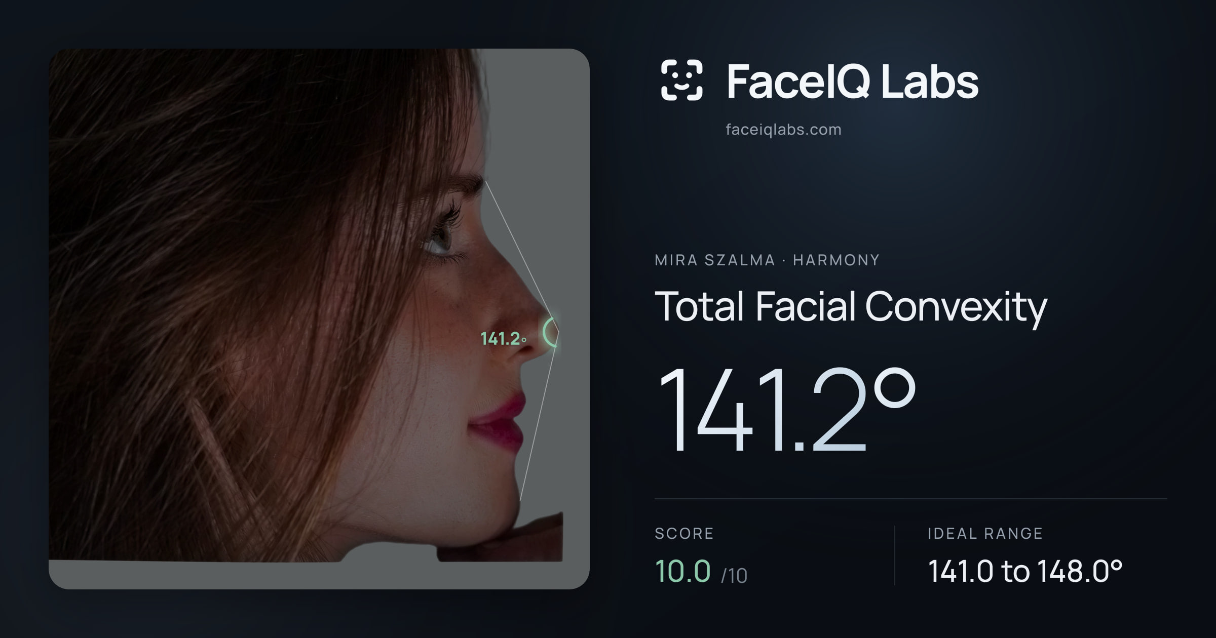 Mira Szalma Total Facial Convexity: 141.2°, drawn on the photo