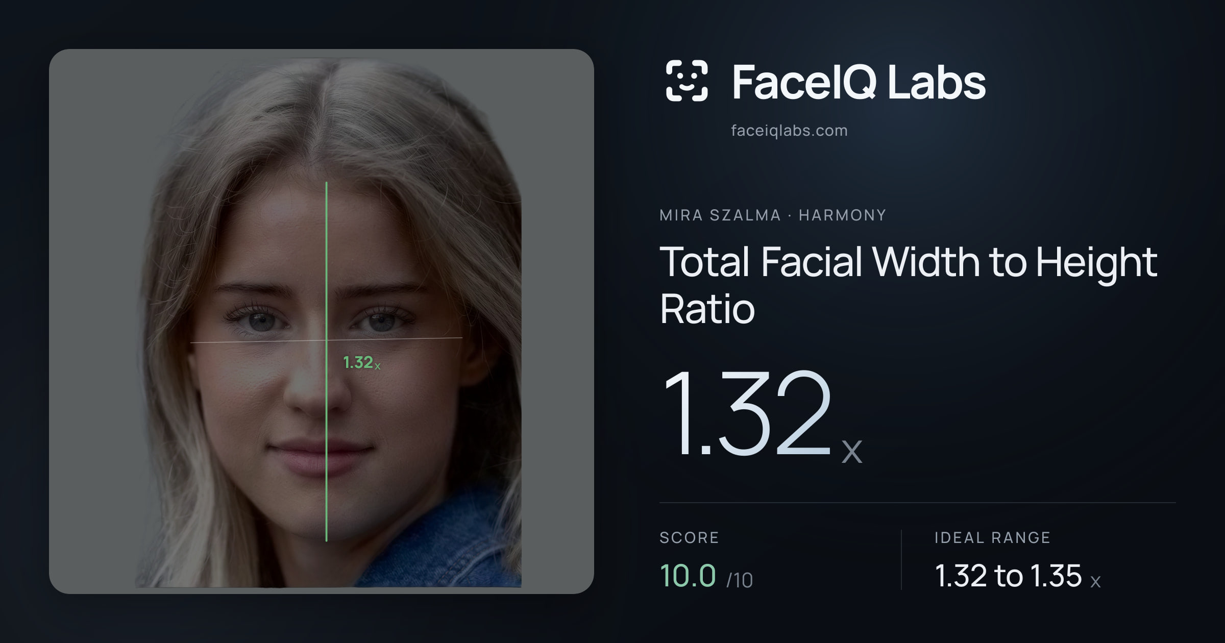 Mira Szalma Total Facial Width to Height Ratio: 1.32x, drawn on the photo