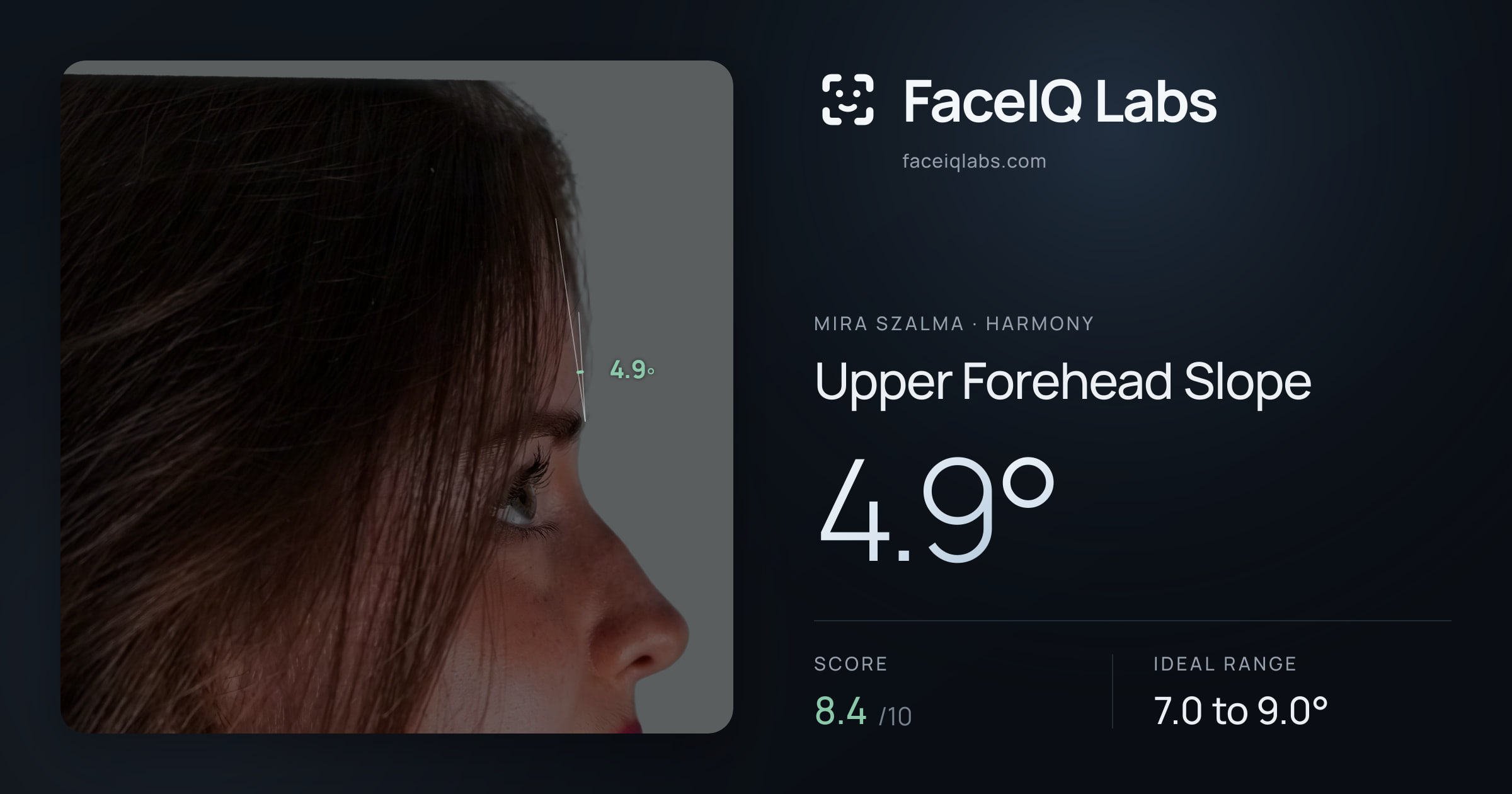 Mira Szalma Upper Forehead Slope: 4.9°, drawn on the photo