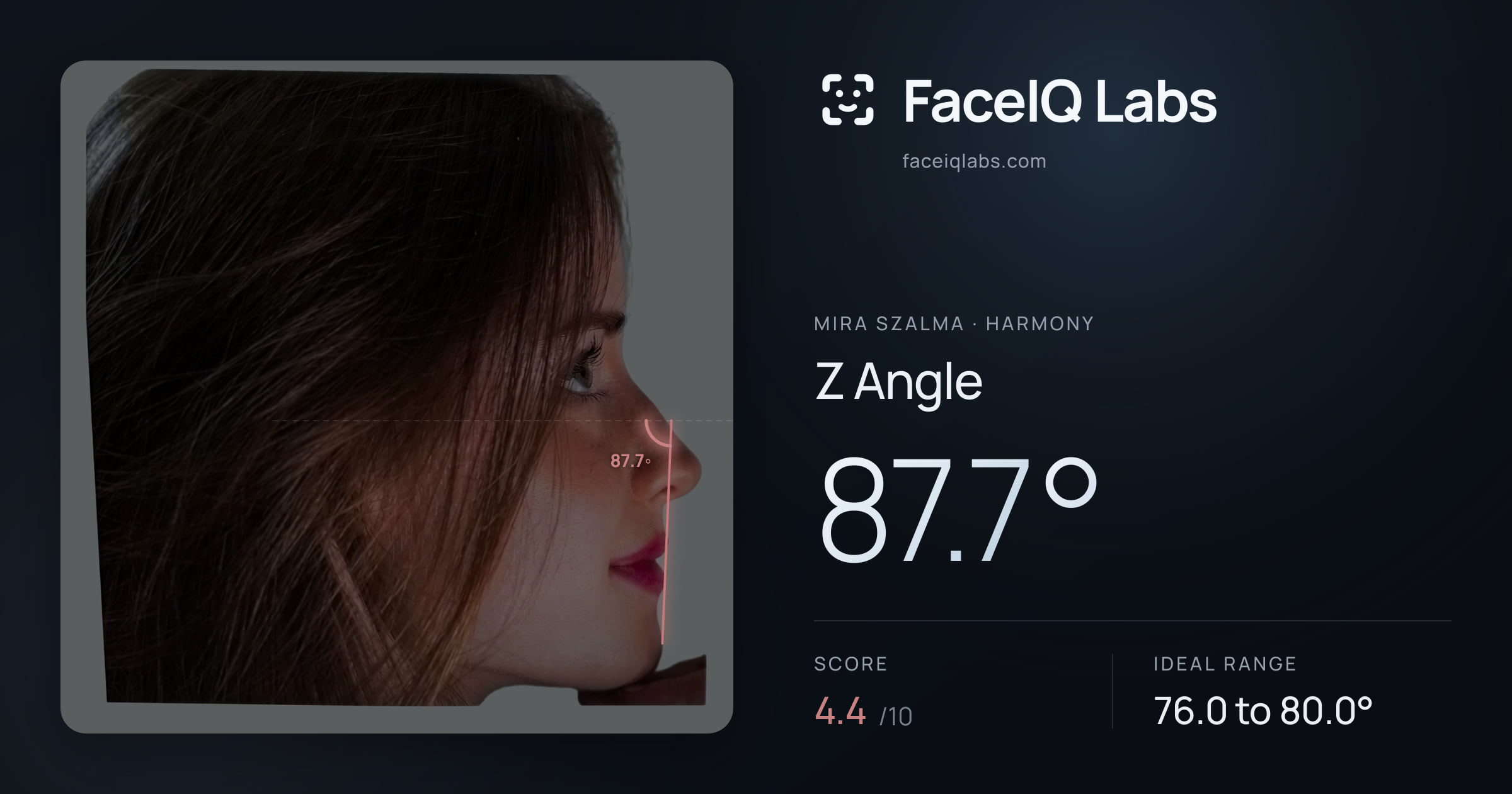 Mira Szalma Z Angle: 87.7°, drawn on the photo