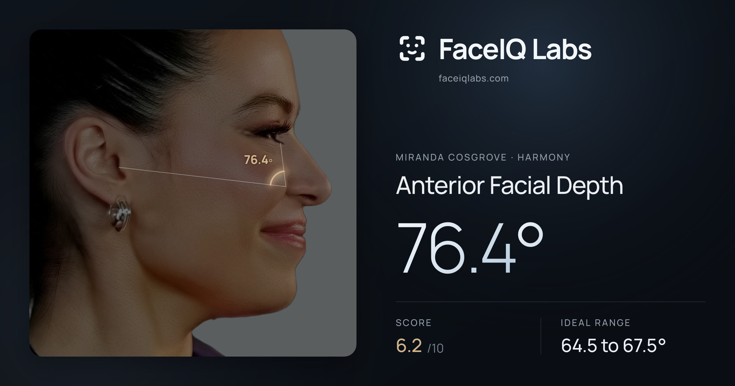 Miranda Cosgrove Anterior Facial Depth: 76.4°, drawn on the photo