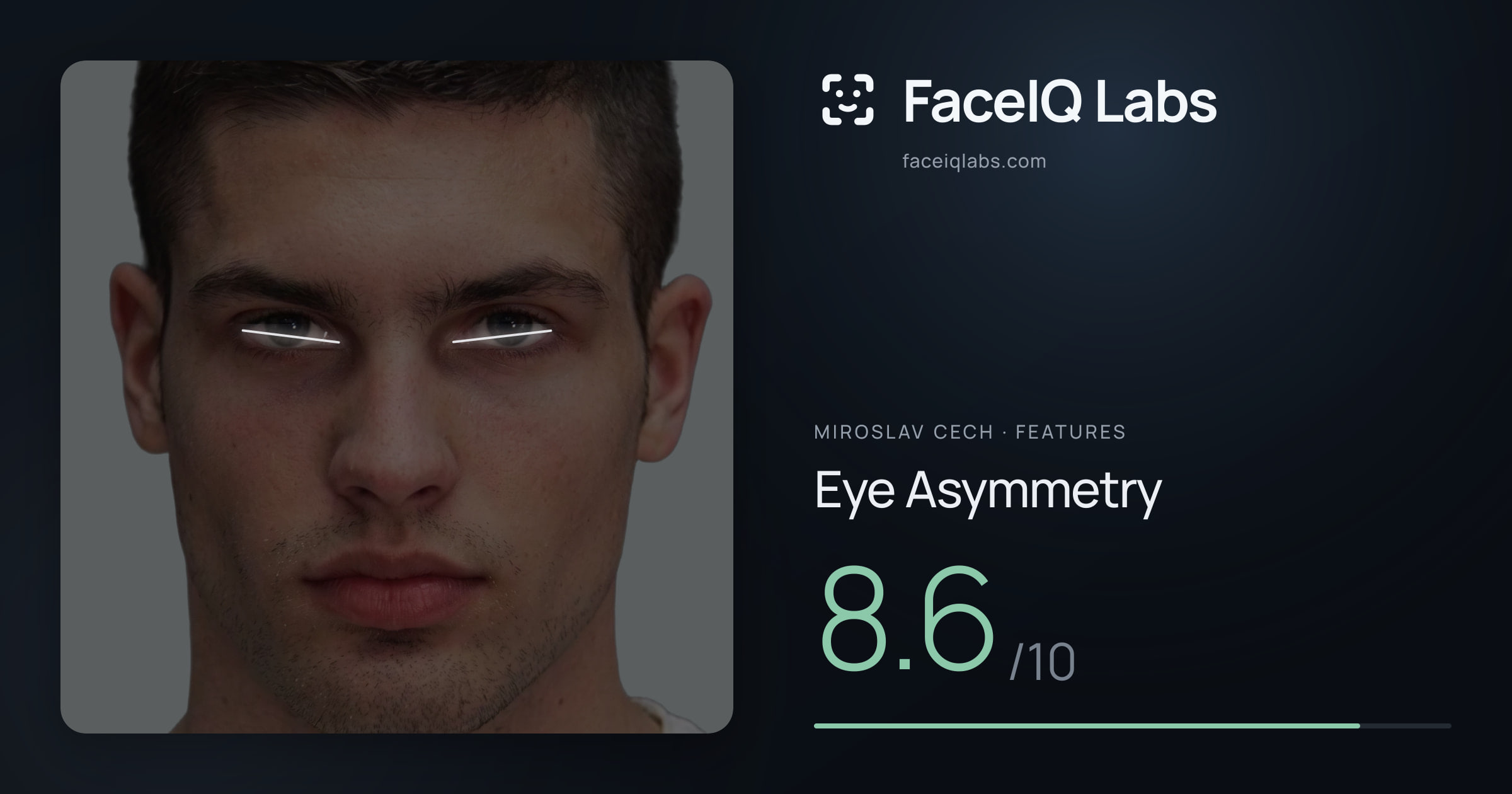 Miroslav Cech Eye Asymmetry: 8.6/10, drawn on the photo