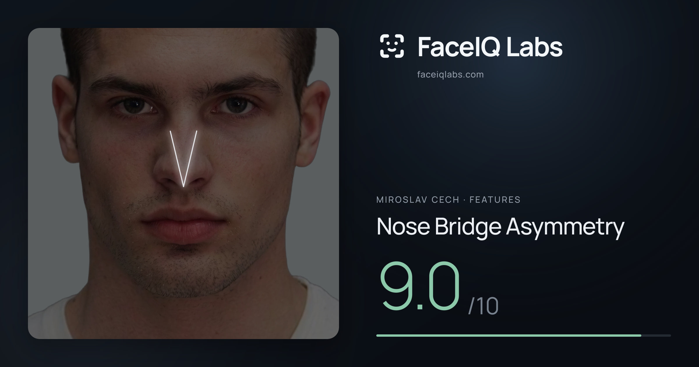 Miroslav Cech Nose Bridge Asymmetry: 9.0/10, drawn on the photo